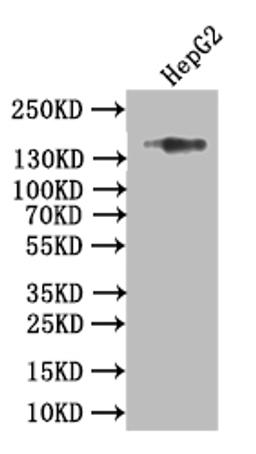 Western Blot. Positive WB detected in: HEPG2 whole cell lysate. All lanes: Collagen XVII antibody at 1:1000. Secondary. Goat polyclonal to rabbit IgG at 1/50000 dilution. Predicted band size: 150 kDa. Observed band size: 150 kDa. 