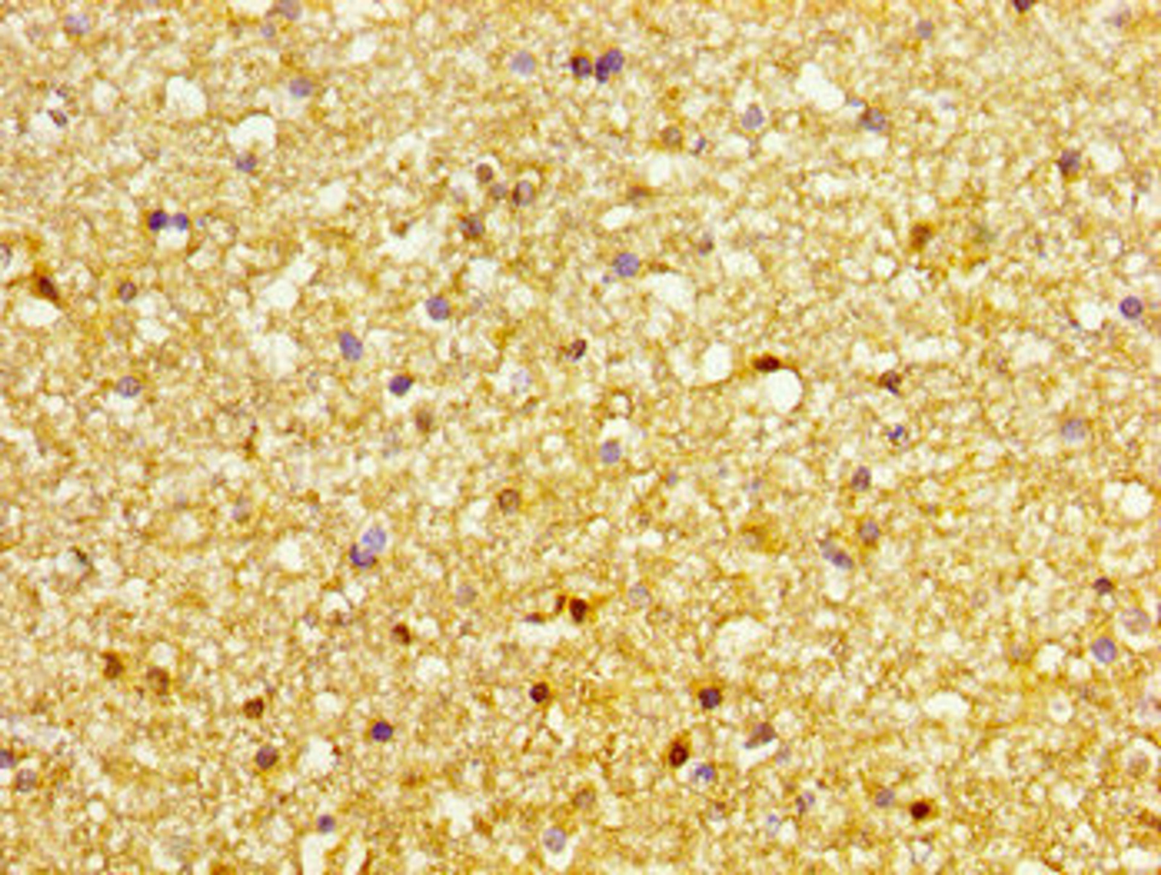 IHC image of CSB-PA856442LA01HU diluted at 1:200 and staining in paraffin-embedded human brain tissue performed on a Leica BondTM system. After dewaxing and hydration, antigen retrieval was mediated by high pressure in a citrate buffer (pH 6.0). Section was blocked with 10% normal goat serum 30min at RT. Then primary antibody (1% BSA) was incubated at 4&deg;C overnight. The primary is detected by a biotinylated secondary antibody and visualized using an HRP conjugated SP system.