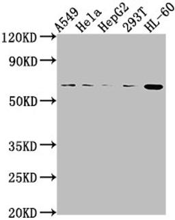 Western Blot. Positive WB detected in: A549 whole cell lysate, Hela whole cell lysate, HepG2 whole cell lysate, 293T whole cell lysate, HL60 whole cell lysate. All lanes: MDM2 antibody at 1:2000. Secondary. Goat polyclonal to rabbit IgG at 1/50000 dilution. Predicted band size: 56, 34, 31, 25, 36, 15, 12, 49, 50 kDa. Observed band size: 56 kDa