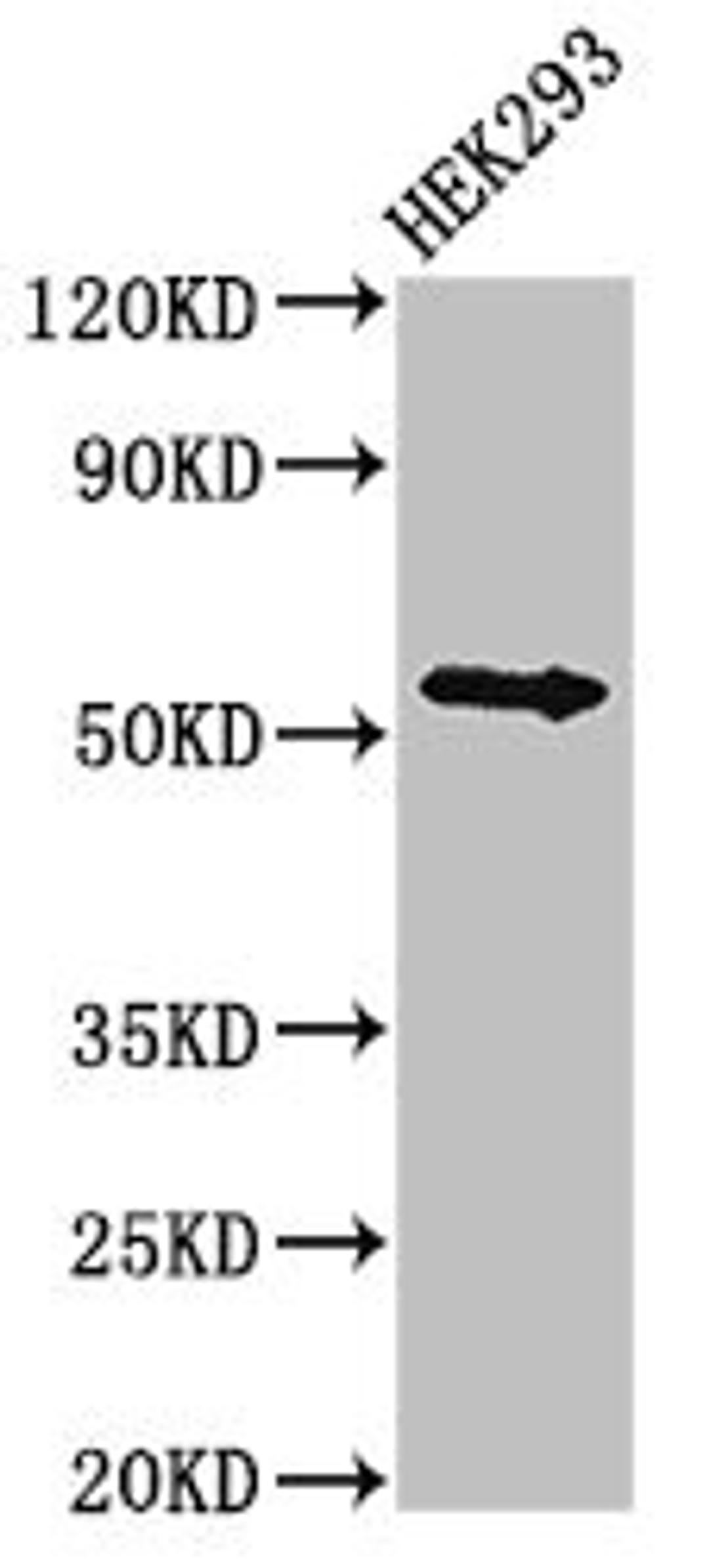 Western Blot. Positive WB detected in: HEK293 whole cell lysate. All lanes: NR1H4 antibody at 3µg/ml. Secondary. Goat polyclonal to rabbit IgG at 1/50000 dilution. Predicted band size: 56, 55, 49 kDa. Observed band size: 56 kDa