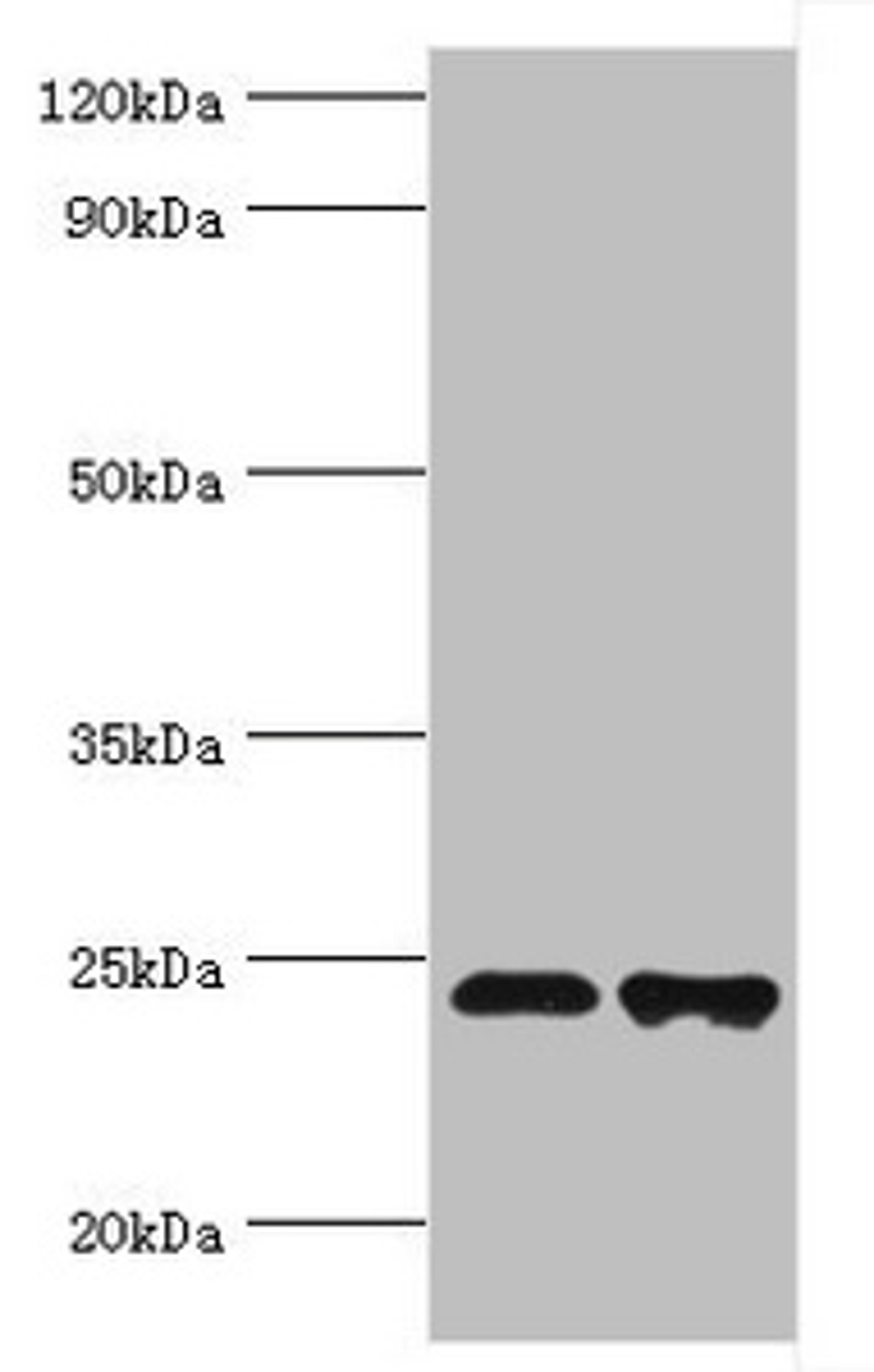 Western blot. All lanes: Toll/interleukin-1 receptor domain-containing adapter protein antibody at 2ug/ml. Lane 1: K562 whole cell lysate. Lane 2: Mouse kidney tissue. Secondary. Goat polyclonal to rabbit IgG at 1/10000 dilution. Predicted band size: 24, 26, 28 kDa. Observed band size: 24 kDa. 