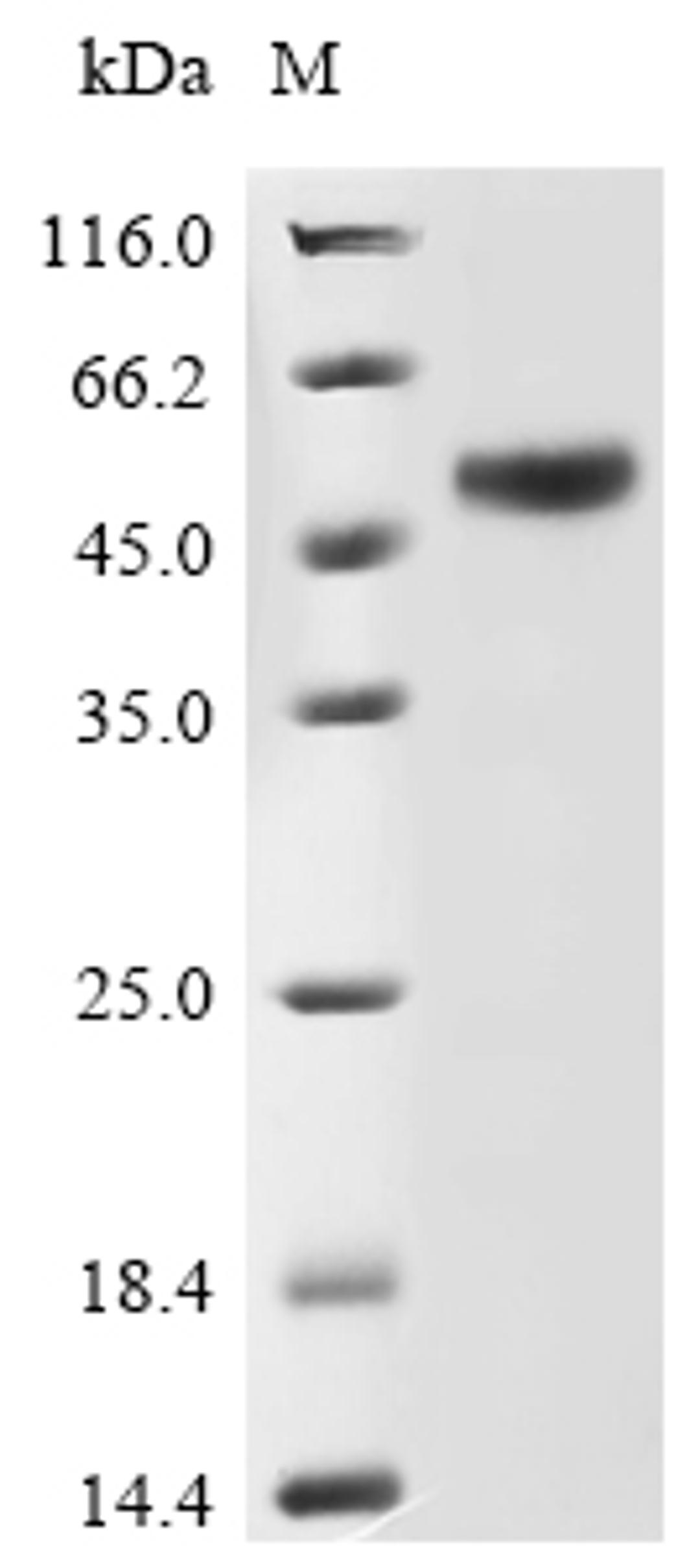 (Tris-Glycine gel) Discontinuous SDS-PAGE (reduced) with 5% enrichment gel and 15% separation gel.