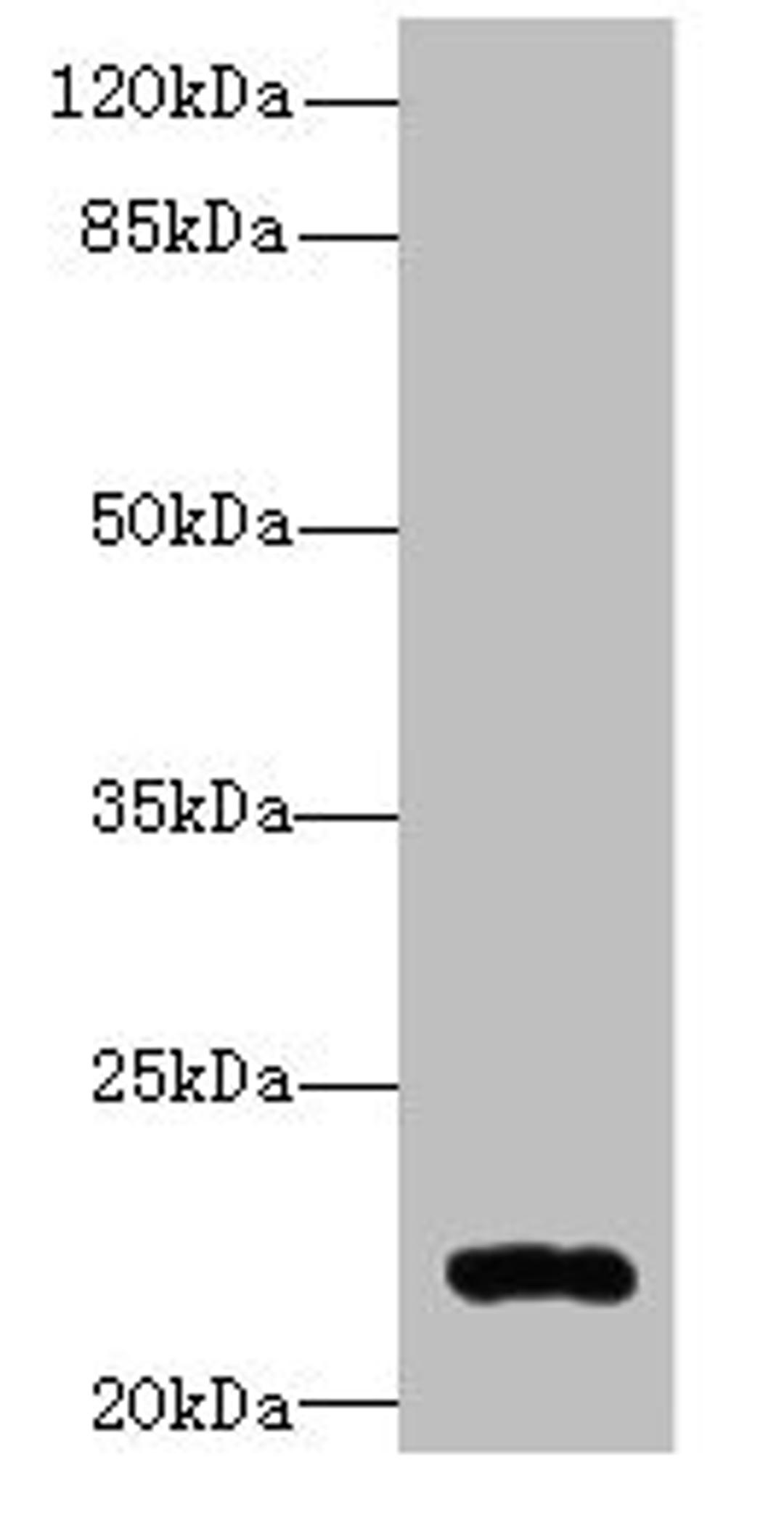 Western blot. All lanes: ARL14 antibody at 0.3µg/ml + MCF-7 whole cell lysate. Secondary. Goat polyclonal to rabbit IgG at 1/10000 dilution. Predicted band size: 22 kDa. Observed band size: 22 kDa
