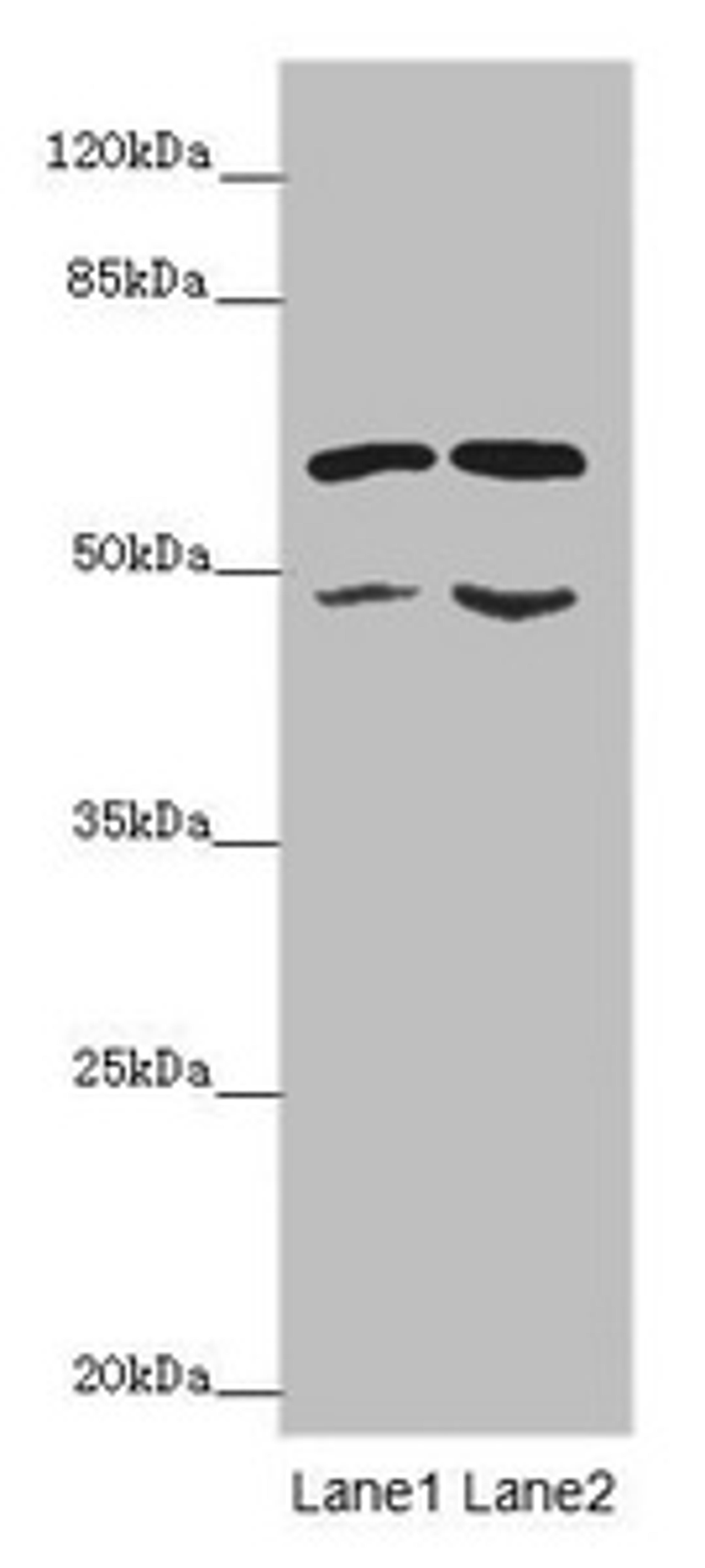 Western blot. All lanes: ST3GAL5 antibody at 6.2 ug/ml. Lane 1: K562 whole cell lysate. Lane 2: U251 whole cell lysate. Secondary. Goat polyclonal to rabbit IgG at 1/10000 dilution. Predicted band size: 48, 46 kDa. Observed band size: 48, 60 kDa. 