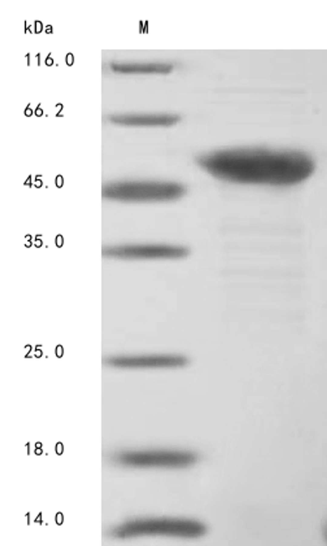 (Tris-Glycine gel) Discontinuous SDS-PAGE (reduced) with 5% enrichment gel and 15% separation gel.