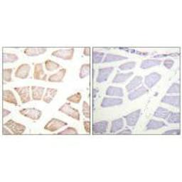 Immunohistochemistry analysis of paraffin-embedded human skeletal muscle tissue using Akt (Ab-129) antibody.