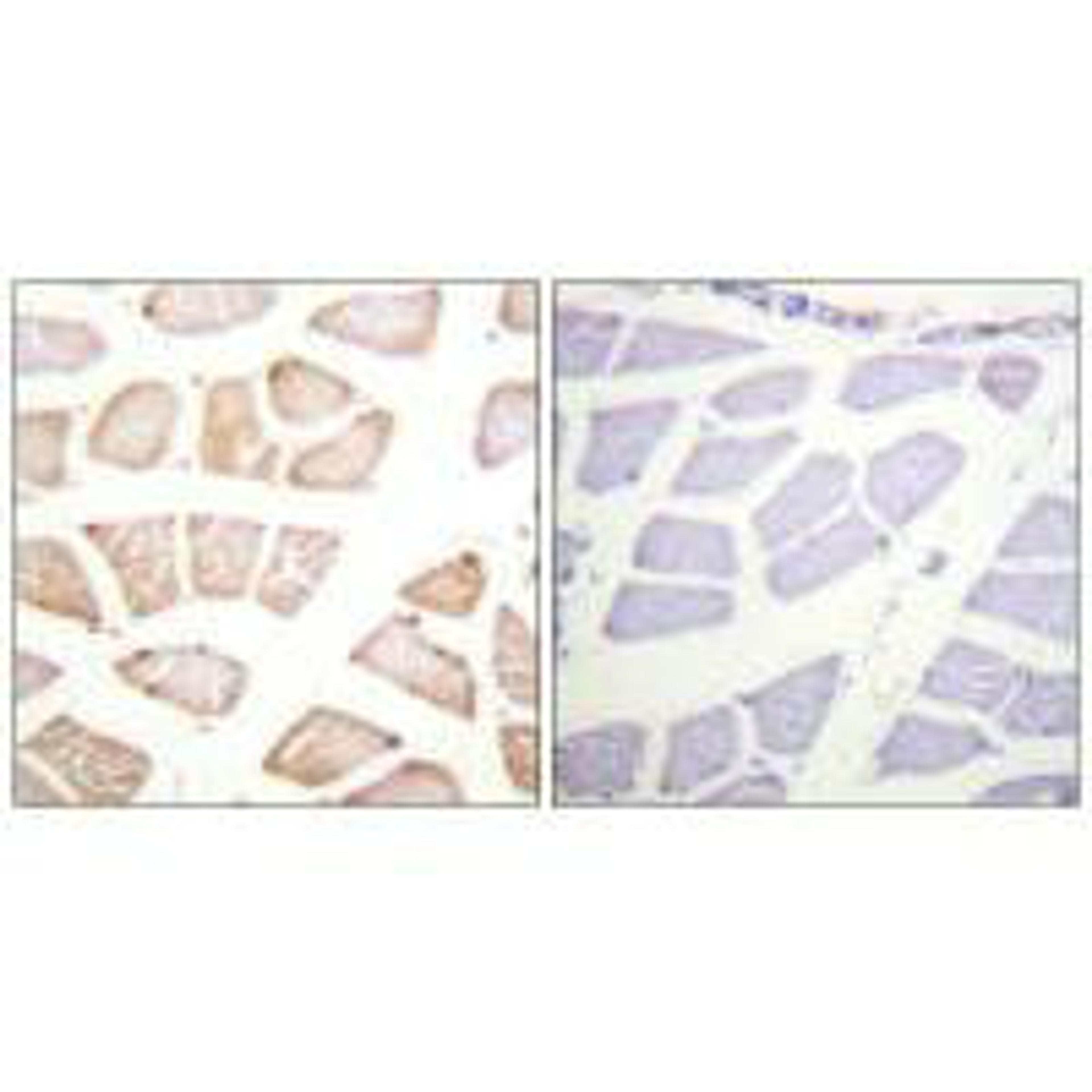 Immunohistochemistry analysis of paraffin-embedded human skeletal muscle tissue using Akt (Ab-129) antibody.