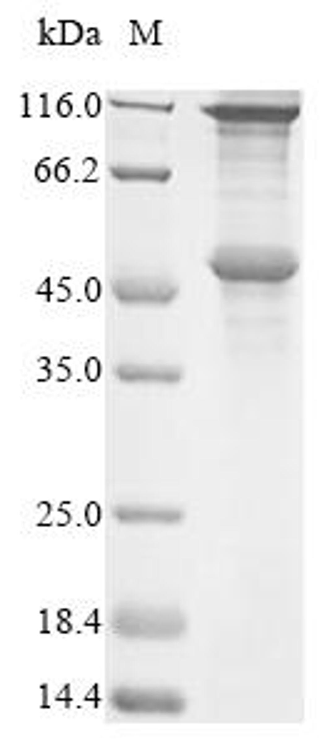 (Tris-Glycine gel) Discontinuous SDS-PAGE (reduced) with 5% enrichment gel and 15% separation gel.