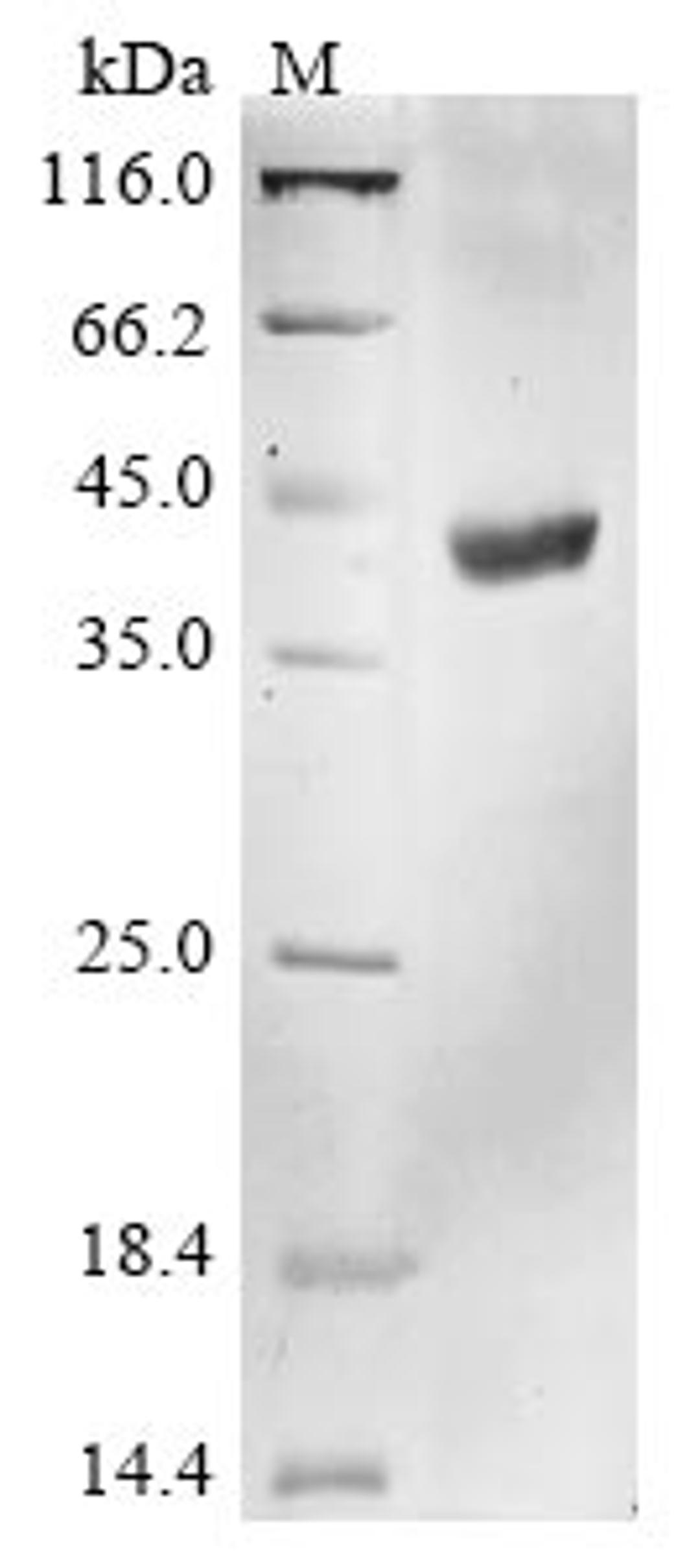 (Tris-Glycine gel) Discontinuous SDS-PAGE (reduced) with 5% enrichment gel and 15% separation gel.