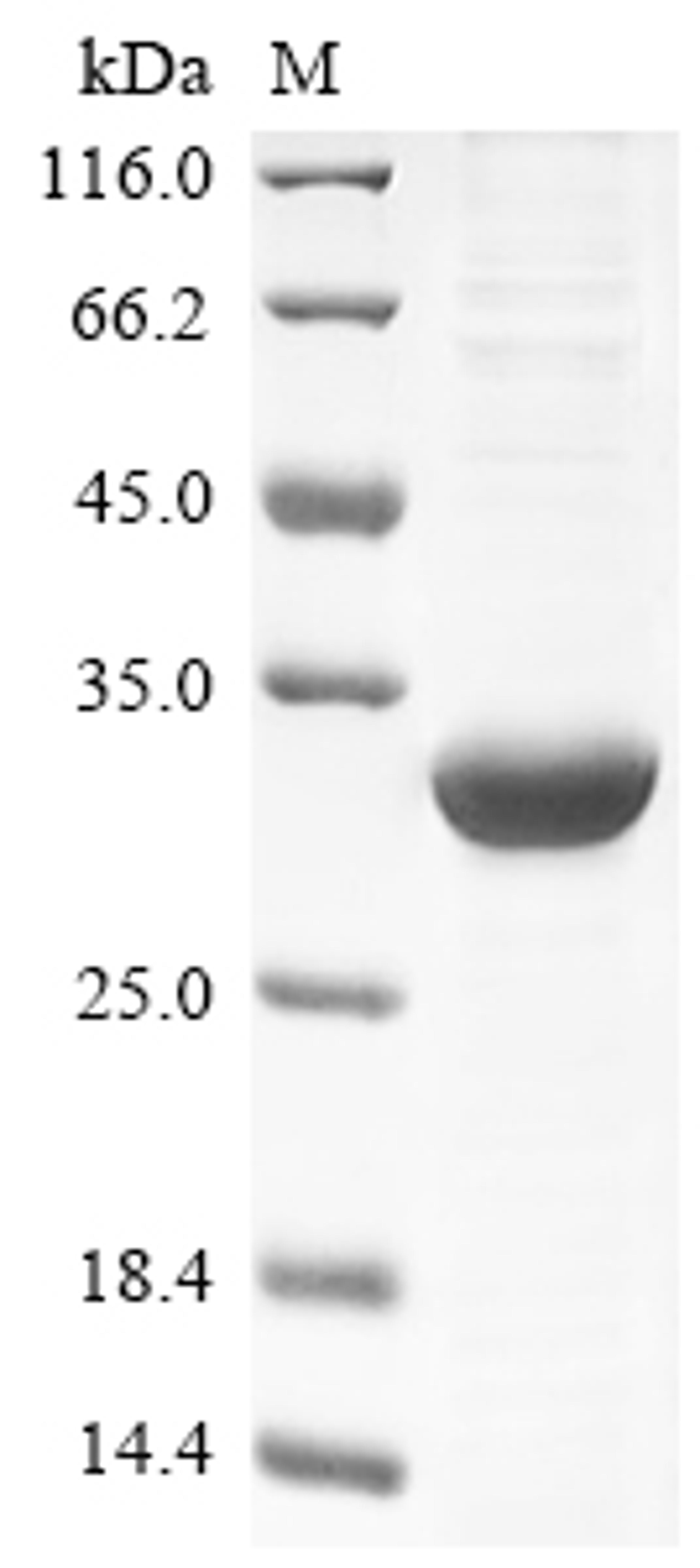 (Tris-Glycine gel) Discontinuous SDS-PAGE (reduced) with 5% enrichment gel and 15% separation gel.