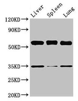 Western Blot. Positive WB detected in: Mouse liver tissue, Mouse spleen tissue, Mouse lung tissue. All lanes: Gba antibody at 3.5µg/ml. Secondary. Goat polyclonal to rabbit IgG at 1/50000 dilution. Predicted band size: 58 kDa. Observed band size: 58 kDa