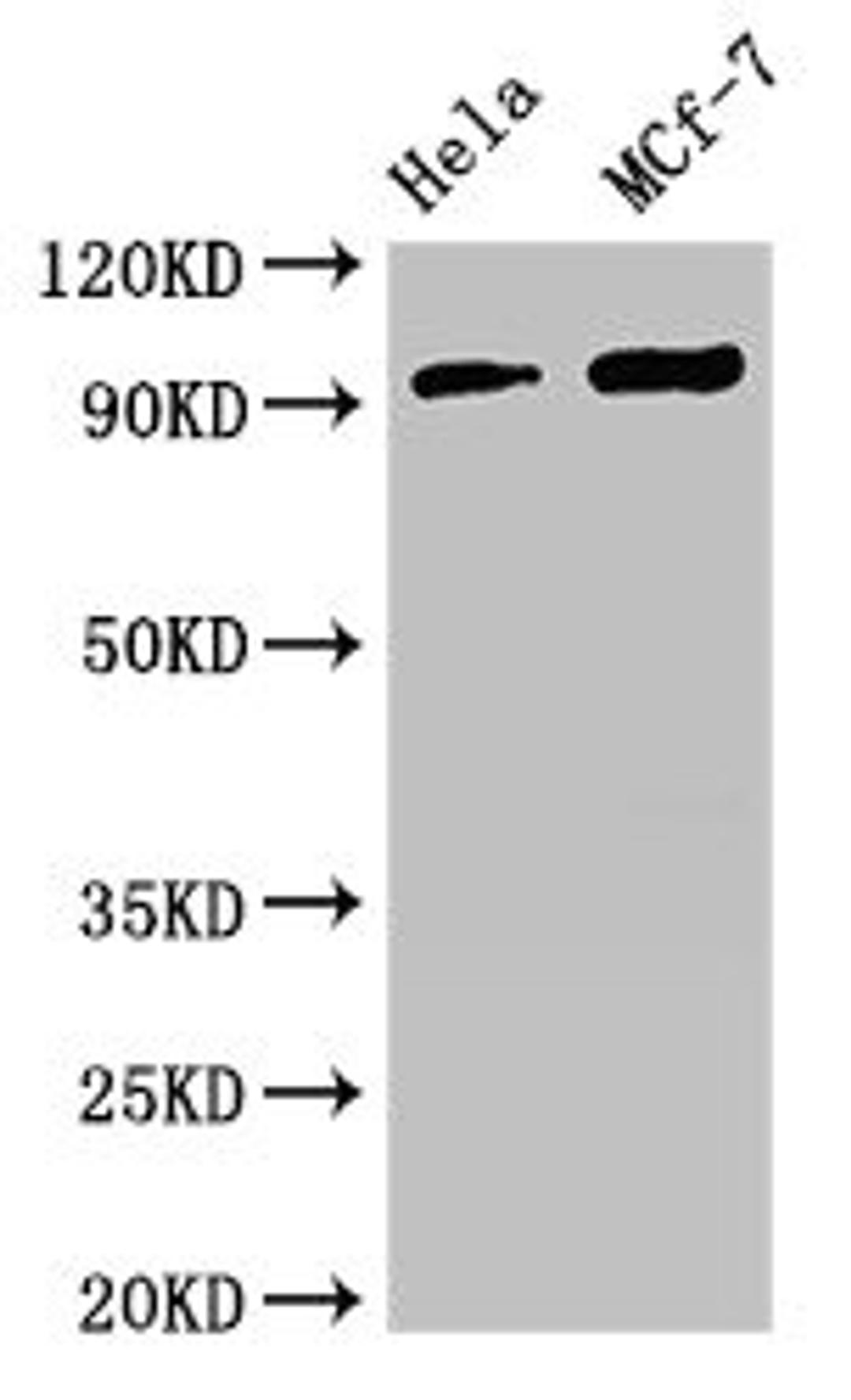 Western Blot. Positive WB detected in: Hela whole cell lysate, MCF-7 whole cell lysate. All lanes: TTC27 antibody at 2.7ug/ml. Secondary. Goat polyclonal to rabbit IgG at 1/50000 dilution. Predicted band size: 97 kDa. Observed band size: 97 kDa. 