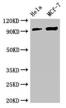 Western Blot. Positive WB detected in: Hela whole cell lysate, MCF-7 whole cell lysate. All lanes: TTC27 antibody at 2.7ug/ml. Secondary. Goat polyclonal to rabbit IgG at 1/50000 dilution. Predicted band size: 97 kDa. Observed band size: 97 kDa. 