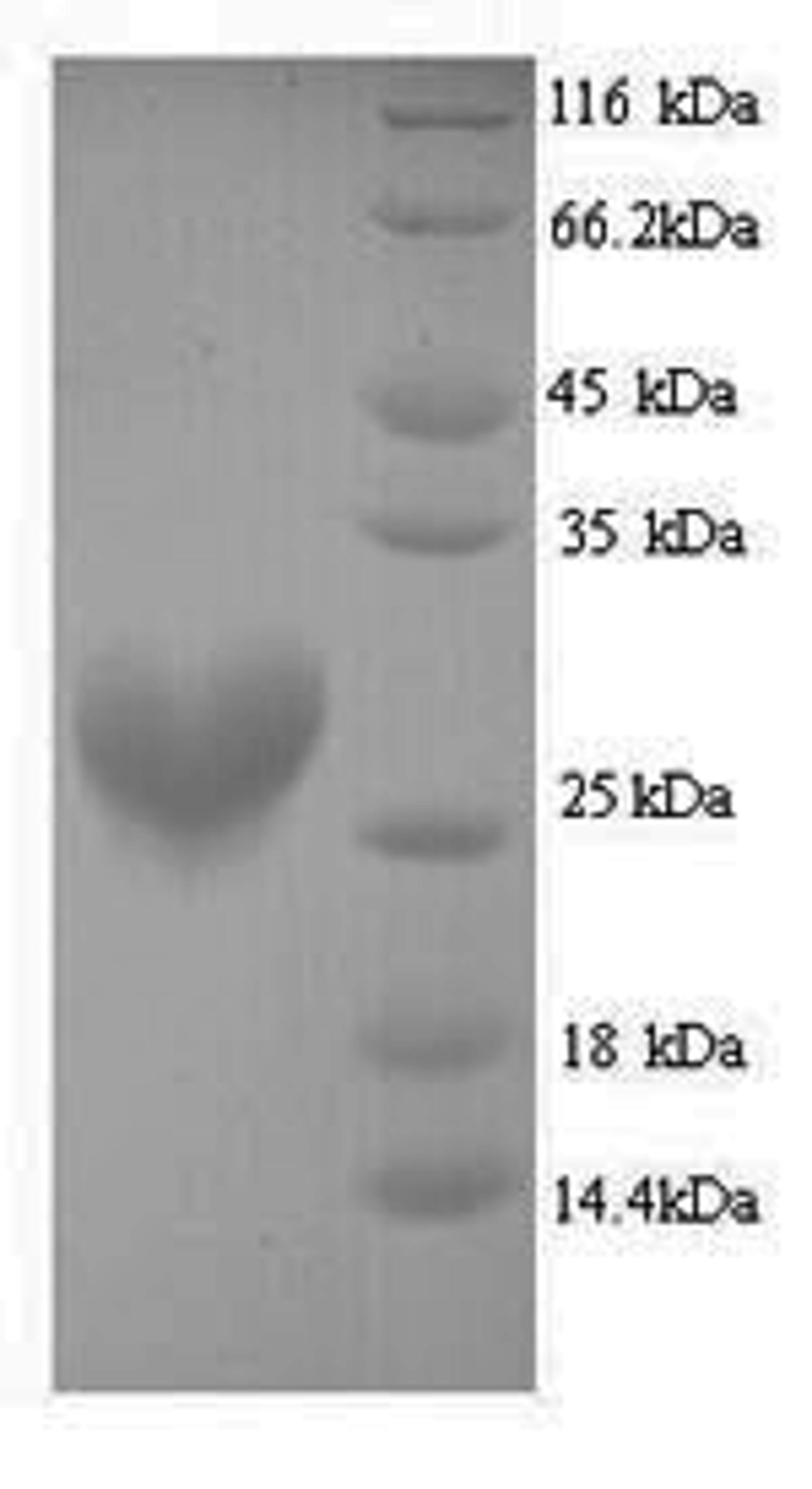 (Tris-Glycine gel) Discontinuous SDS-PAGE (reduced) with 5% enrichment gel and 15% separation gel.