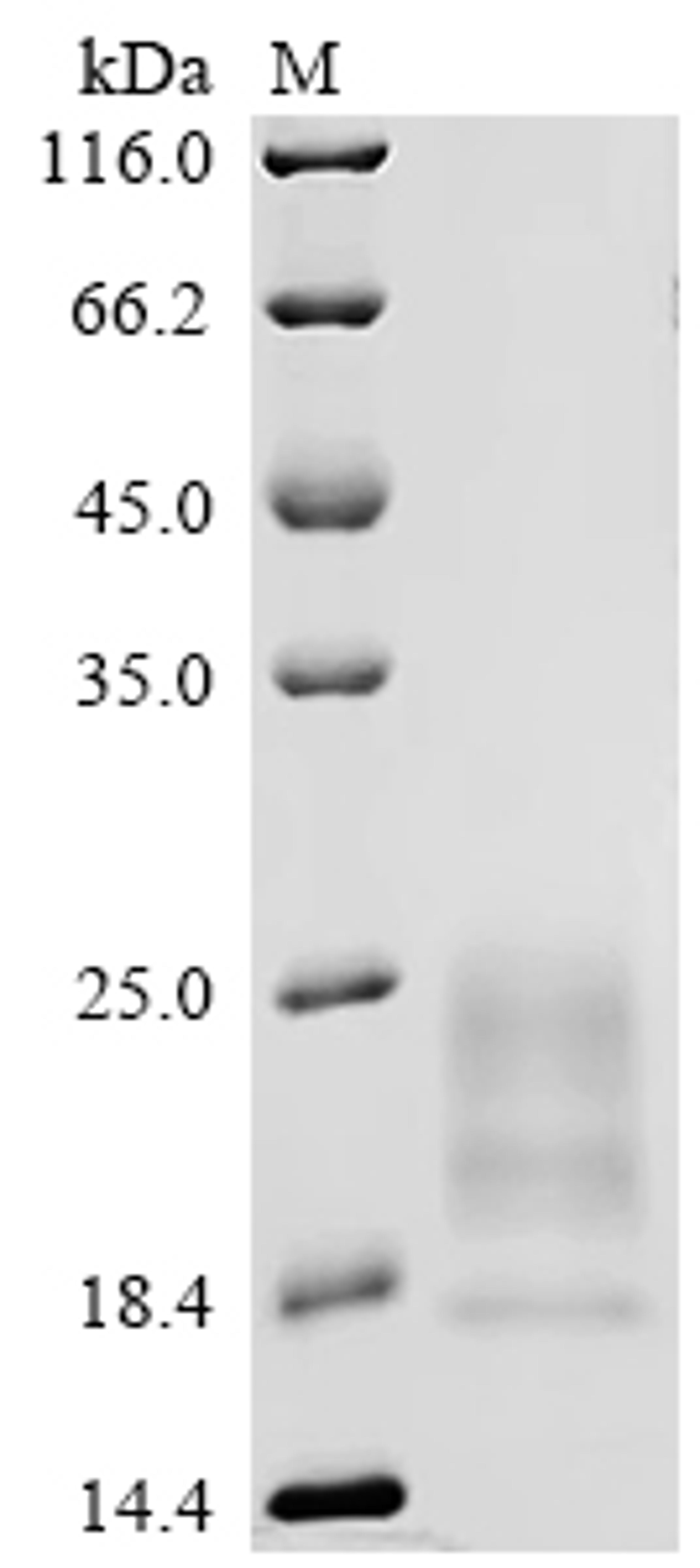 (Tris-Glycine gel) Discontinuous SDS-PAGE (reduced) with 5% enrichment gel and 15% separation gel.