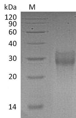(Tris-Glycine gel) Discontinuous SDS-PAGE (reduced) with 5% enrichment gel and 15% separation gel.