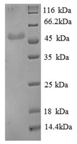 (Tris-Glycine gel) Discontinuous SDS-PAGE (reduced) with 5% enrichment gel and 15% separation gel.