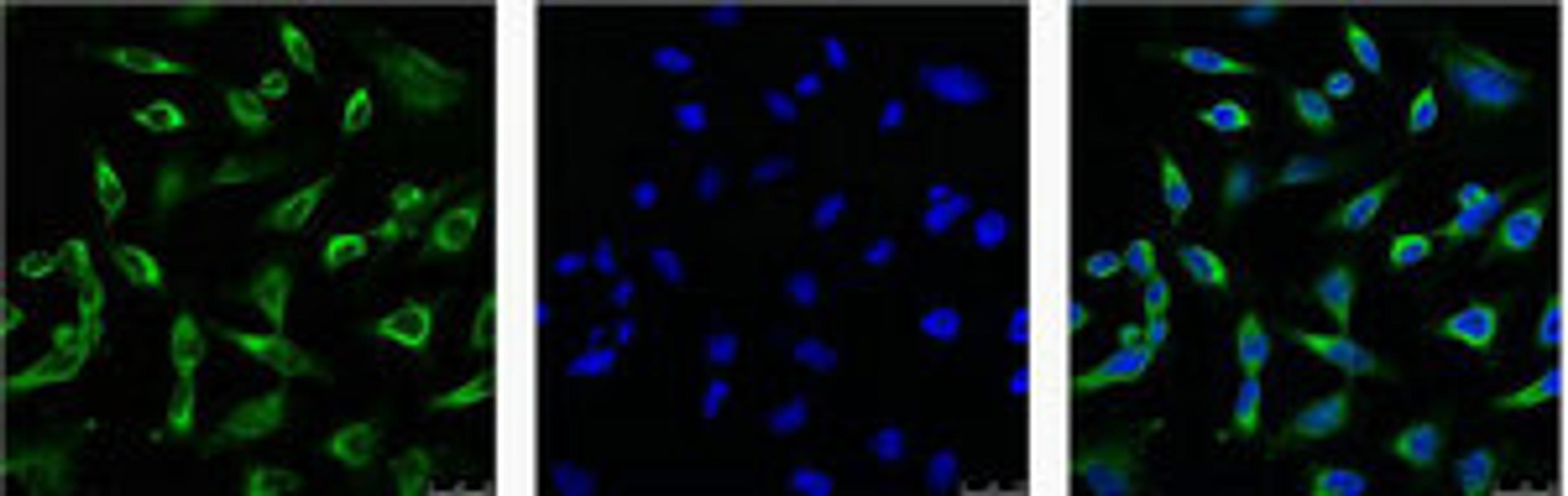 IF analysis of Hela with antibody (Left) and DAPI (Right) diluted at 1:100.
