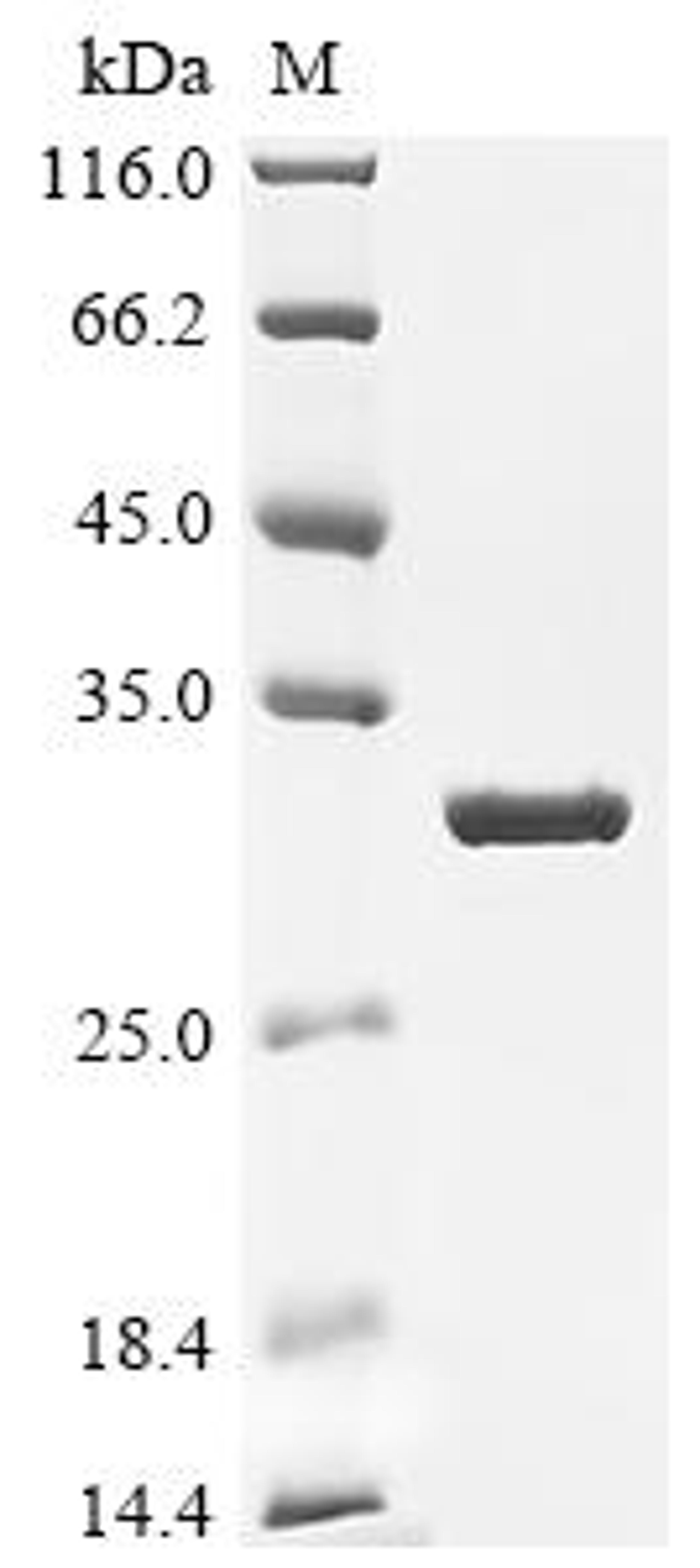 (Tris-Glycine gel) Discontinuous SDS-PAGE (reduced) with 5% enrichment gel and 15% separation gel.
