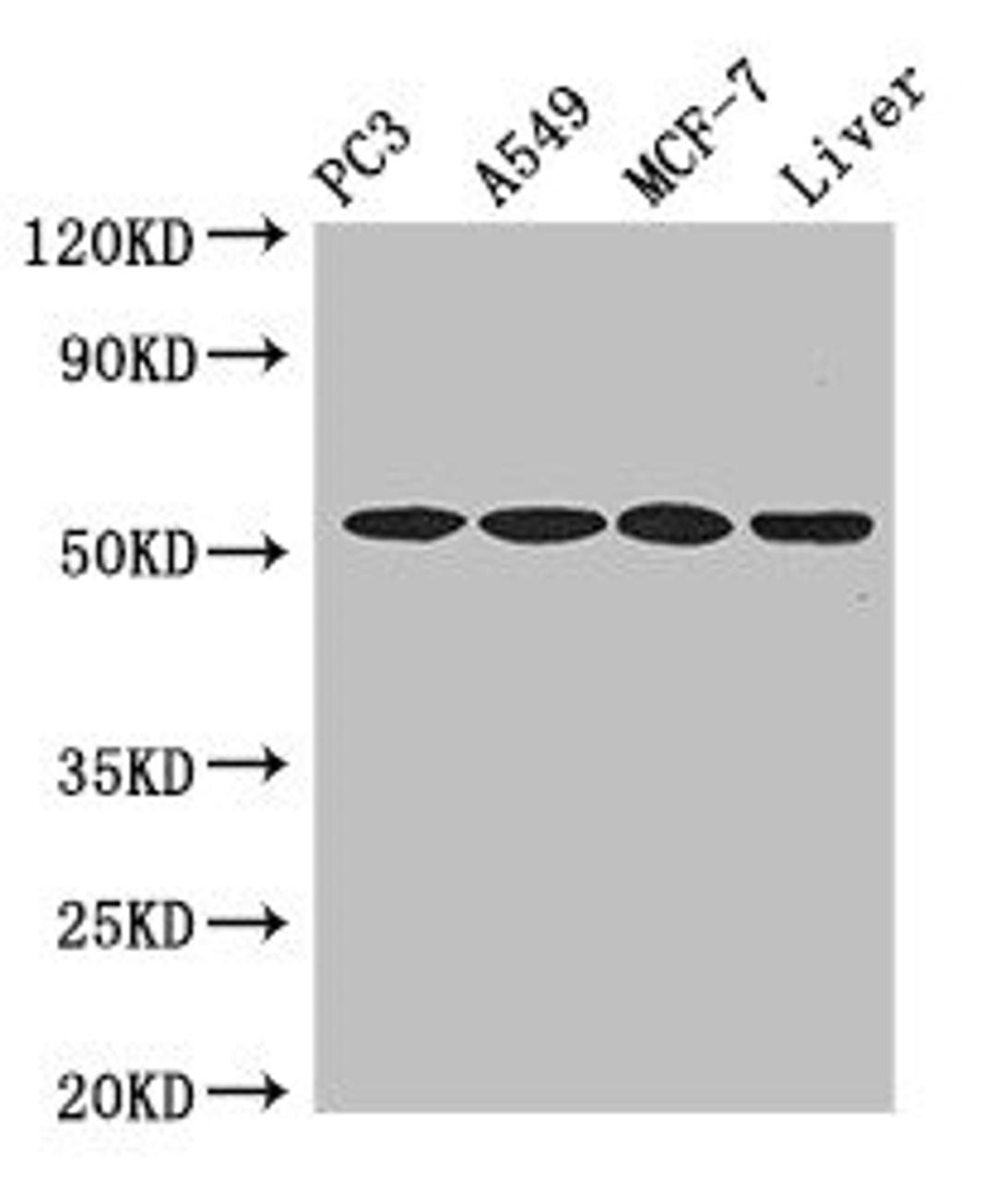 Western Blot. Positive WB detected in: PC-3 whole cell lysate, A549 whole cell lysate, MCF-7 whole cell lysate, , Mouse liver tissue. All lanes: IRF6 antibody at 4ug/ml. Secondary. Goat polyclonal to rabbit IgG at 1/50000 dilution. Predicted band size: 54, 42 kDa. Observed band size: 54 kDa. 
