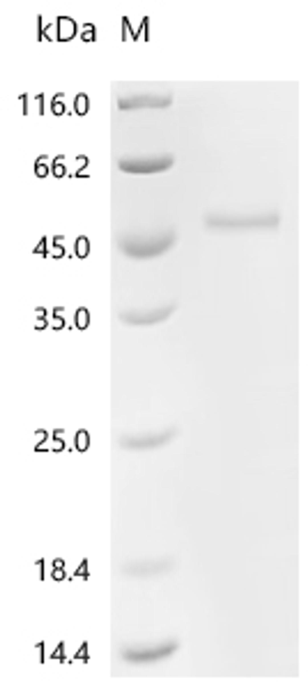 (Tris-Glycine gel) Discontinuous SDS-PAGE (reduced) with 5% enrichment gel and 15% separation gel.