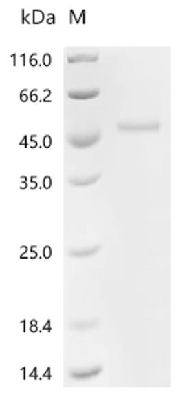(Tris-Glycine gel) Discontinuous SDS-PAGE (reduced) with 5% enrichment gel and 15% separation gel.