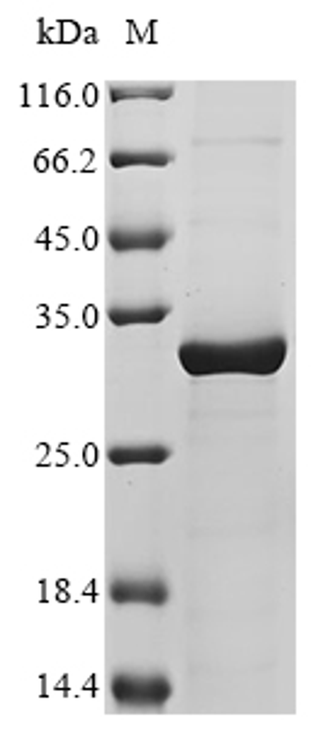 (Tris-Glycine gel) Discontinuous SDS-PAGE (reduced) with 5% enrichment gel and 15% separation gel.