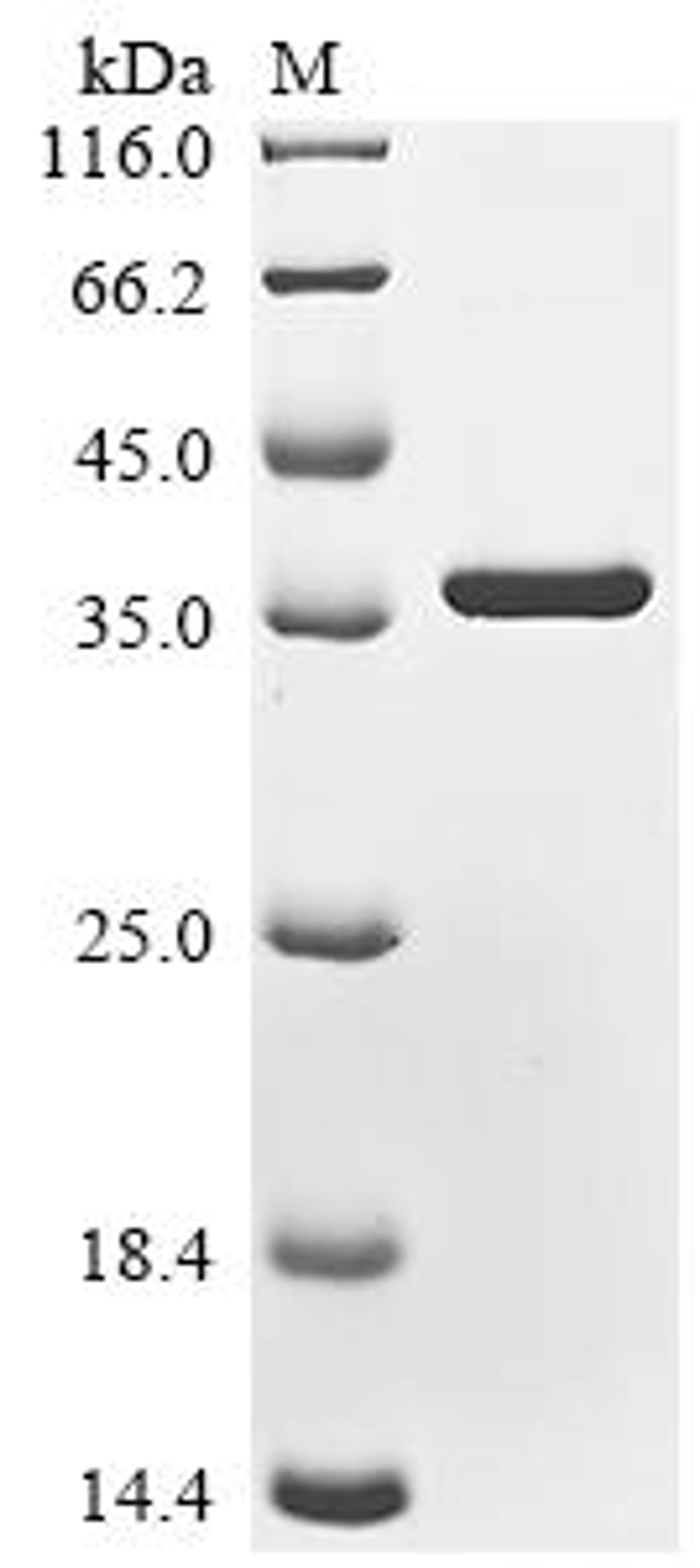 (Tris-Glycine gel) Discontinuous SDS-PAGE (reduced) with 5% enrichment gel and 15% separation gel.