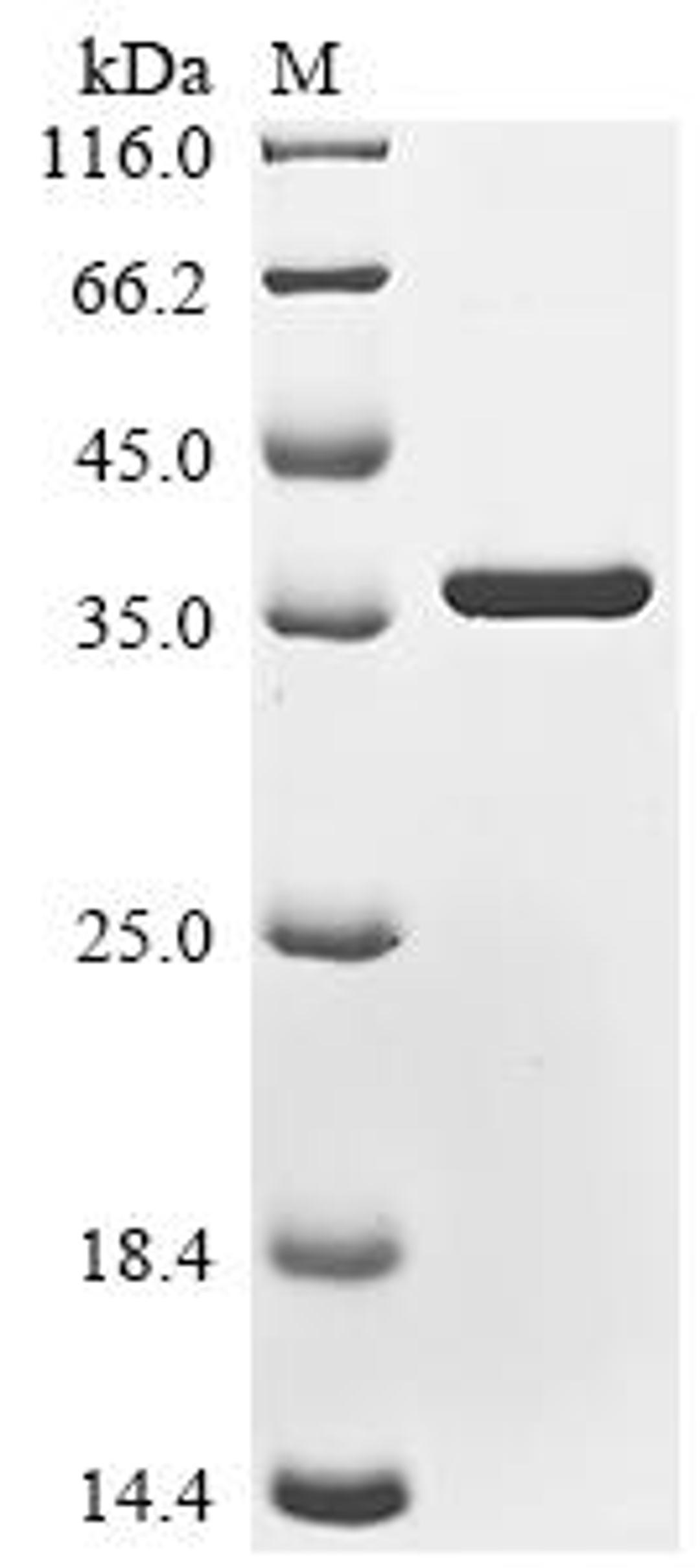 (Tris-Glycine gel) Discontinuous SDS-PAGE (reduced) with 5% enrichment gel and 15% separation gel.