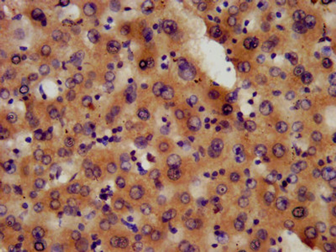 IHC image of CSB-PA619963LA01HU diluted at 1:600 and staining in paraffin-embedded human liver tissue performed on a Leica BondTM system. After dewaxing and hydration, antigen retrieval was mediated by high pressure in a citrate buffer (pH 6.0). Section was blocked with 10% normal goat serum 30min at RT. Then primary antibody (1% BSA) was incubated at 4&deg;C overnight. The primary is detected by a biotinylated secondary antibody and visualized using an HRP conjugated SP system.