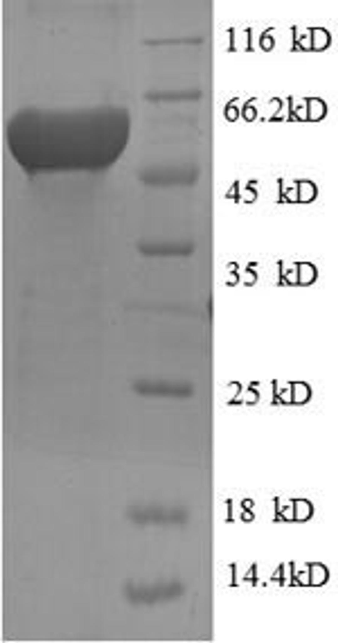 (Tris-Glycine gel) Discontinuous SDS-PAGE (reduced) with 5% enrichment gel and 15% separation gel.