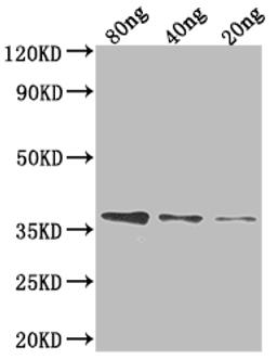 Western Blot. Positive WB detected in Recombinant protein. All lanes: FTSI antibody at 1:2000. Secondary. Goat polyclonal to rabbit IgG at 1/50000 dilution. Predicted band size: 32.4 kDa. Observed band size: 38 kDa. 