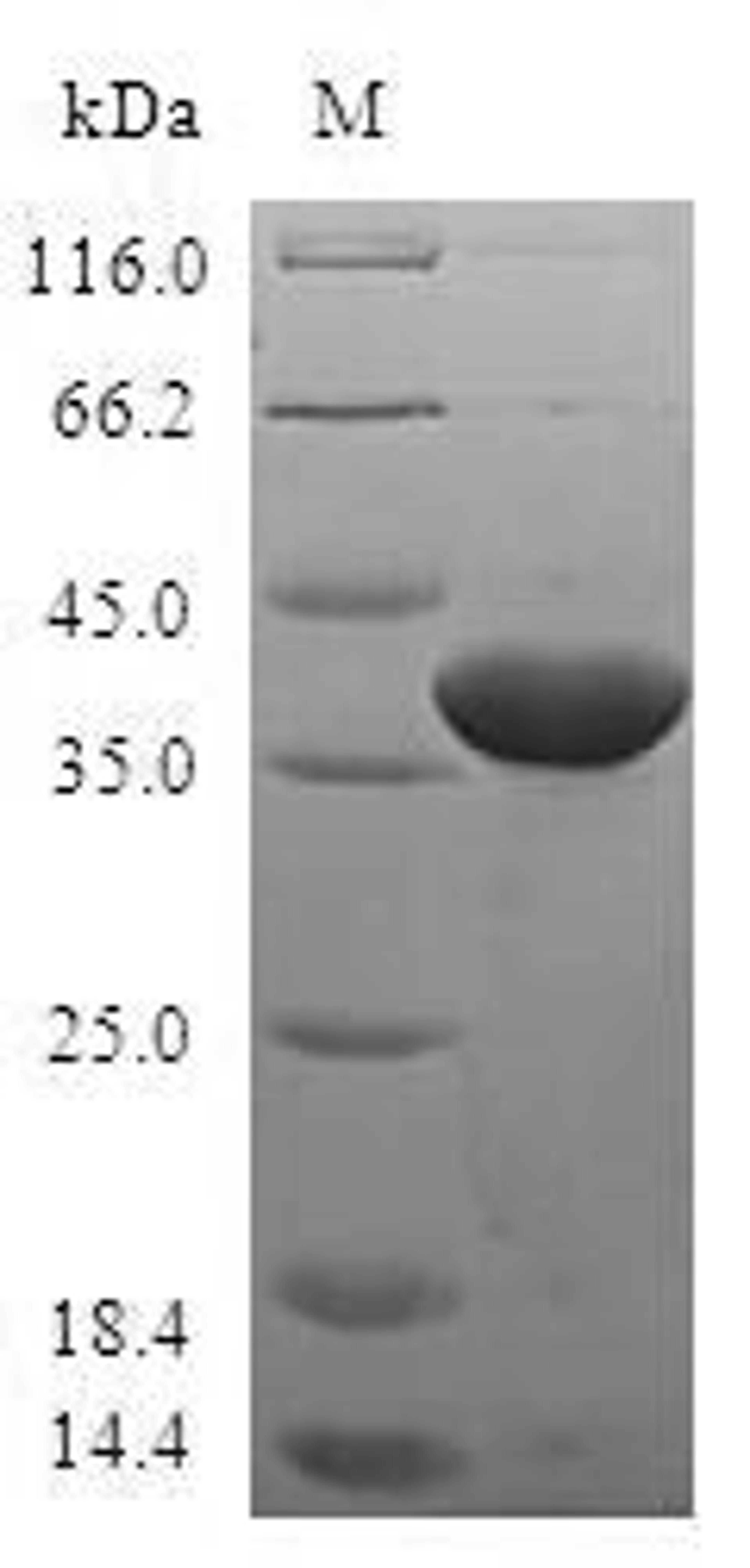 (Tris-Glycine gel) Discontinuous SDS-PAGE (reduced) with 5% enrichment gel and 15% separation gel.