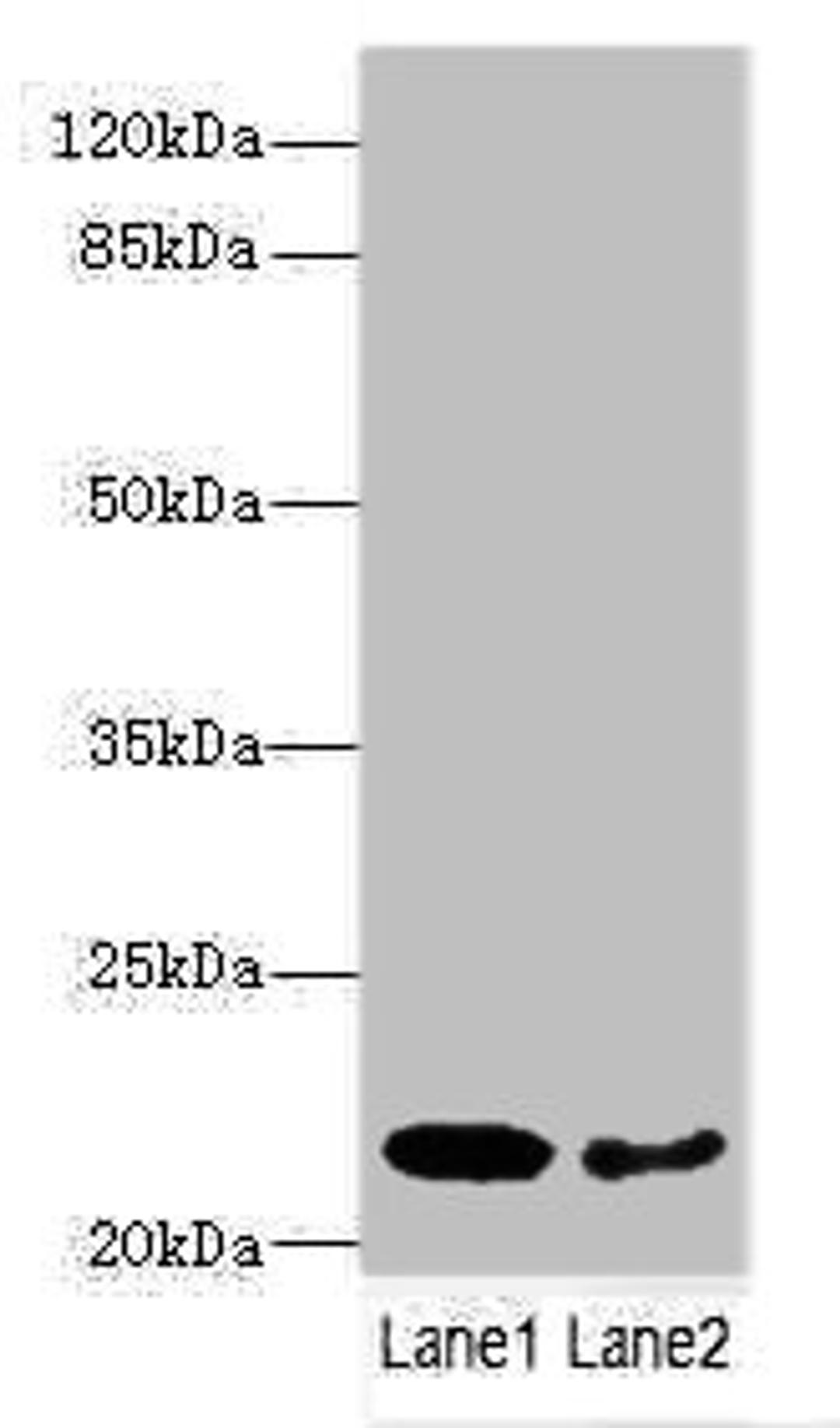 Western blot. All lanes: PRDX2 antibody at 9ug/ml. Lane 1: Mouse liver tissue. Lane 2: Mouse spleen tissue. Secondary. Goat polyclonal to rabbit IgG at 1/10000 dilution. Predicted band size: 22, 16 kDa. Observed band size: 22 kDa. 