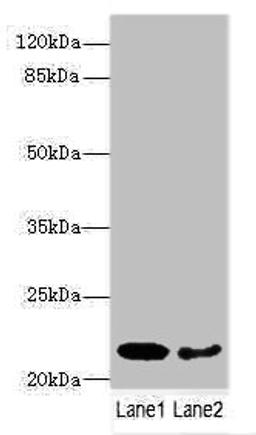 Western blot. All lanes: PRDX2 antibody at 9ug/ml. Lane 1: Mouse liver tissue. Lane 2: Mouse spleen tissue. Secondary. Goat polyclonal to rabbit IgG at 1/10000 dilution. Predicted band size: 22, 16 kDa. Observed band size: 22 kDa. 