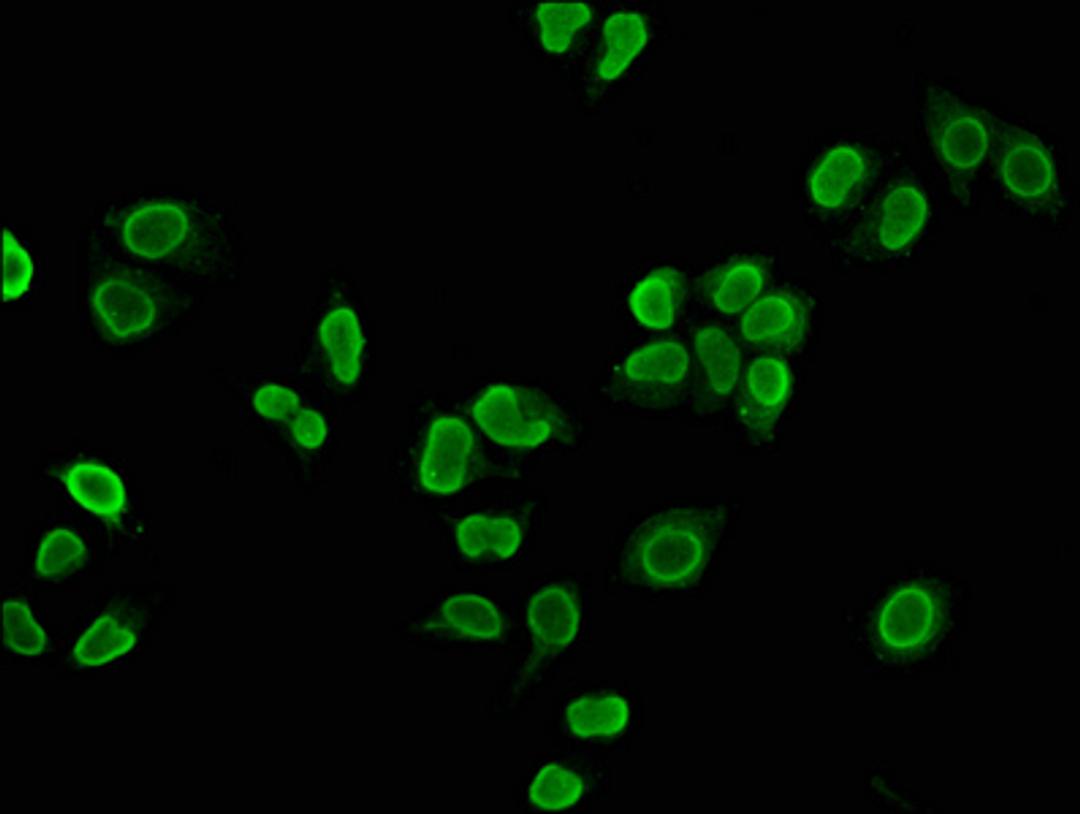 Immunofluorescence staining of Hela cells with CSB-PA010429OA05nme1HU at 1:2.5, counter-stained with DAPI. The cells were fixed in 4% formaldehyde, permeabilized using 0.2% Triton X-100 and blocked in 10% normal Goat Serum. The cells were then incubated with the antibody overnight at 4&deg;C. The secondary antibody was Alexa Fluor 488-congugated AffiniPure Goat Anti-Rabbit IgG(H+L).