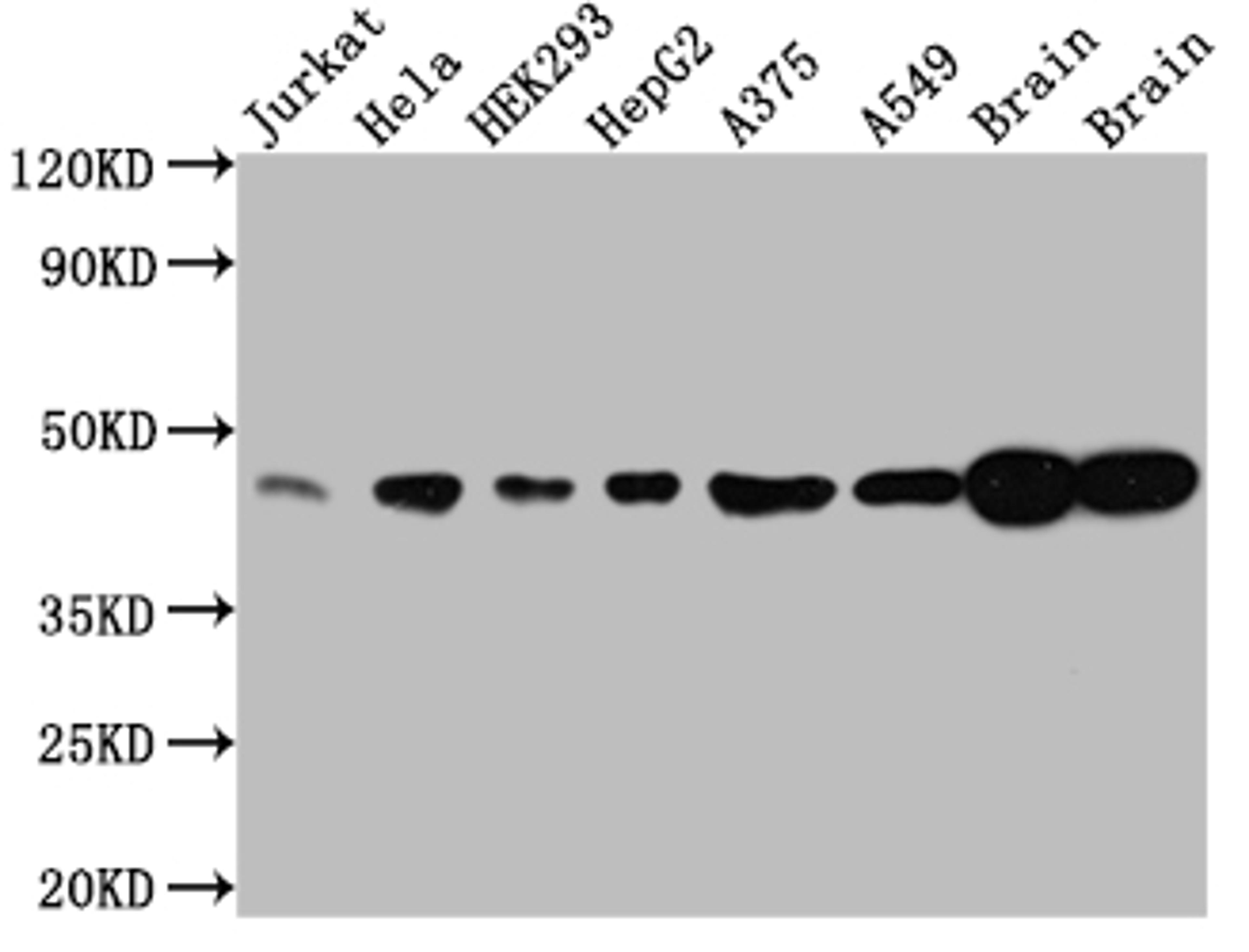 Western Blot. Positive WB detected in: Jurkat whole cell lysate, Hela whole cell lysate, HEK293 whole cell lysate, HepG2 whole cell lysate, A375 whole cell lysate, A549 whole cell lysate, Rat Brain whole cell lysate, Mouse Brain whole cell lysate. All lanes: ERK2 antibody at 1:1000. Secondary. Goat polyclonal to rabbit IgG at 1/50000 dilution. Predicted band size: 42, 37 kDa. Observed band size: 42 kDa.