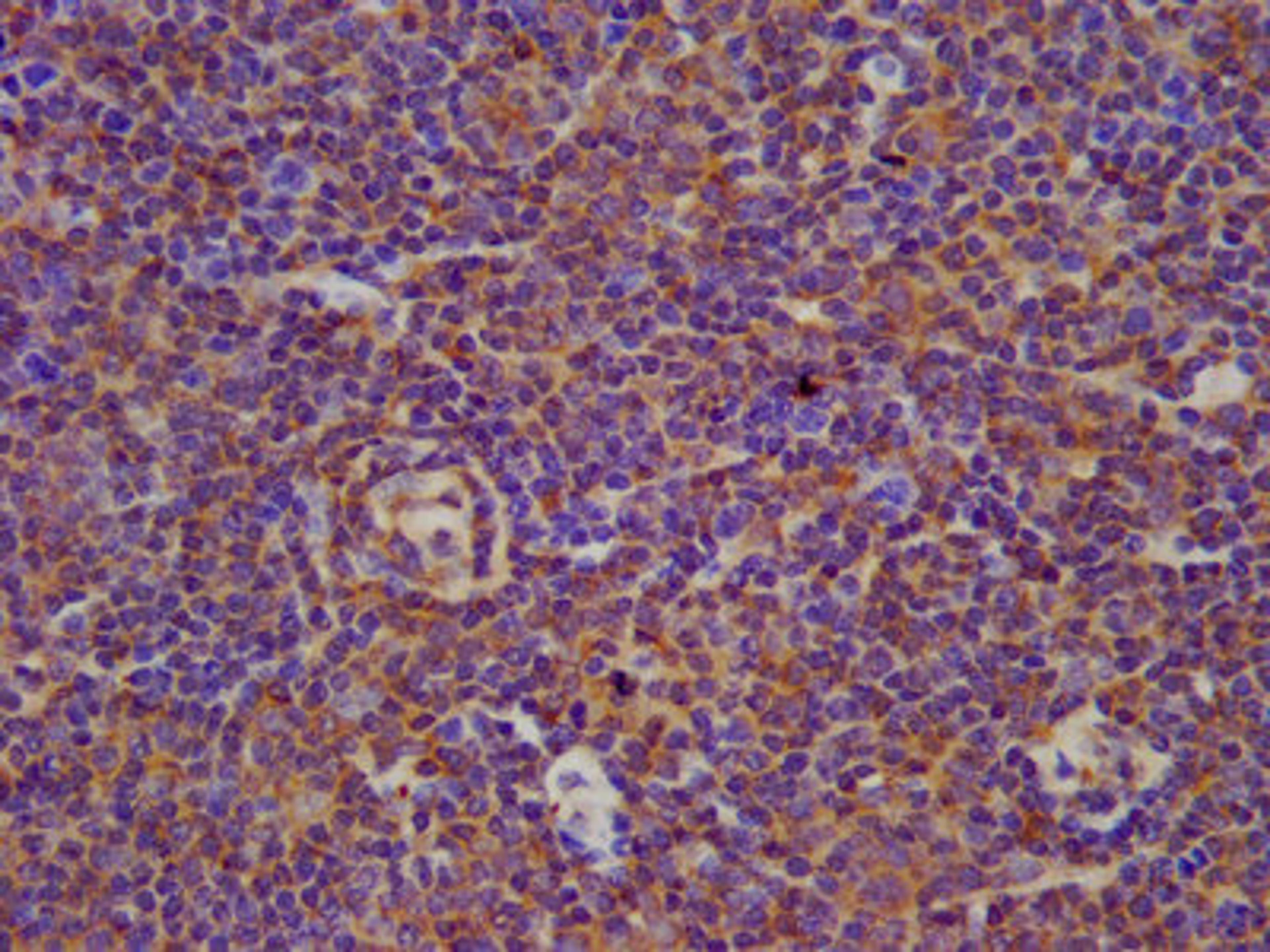 IHC image of CSB-PA002701LA01HU diluted at 1:100 and staining in paraffin-embedded human lymph node tissue performed on a Leica BondTM system. After dewaxing and hydration, antigen retrieval was mediated by high pressure in a citrate buffer (pH 6.0). Section was blocked with 10% normal goat serum 30min at RT. Then primary antibody (1% BSA) was incubated at 4&deg;C overnight. The primary is detected by a biotinylated secondary antibody and visualized using an HRP conjugated SP system.