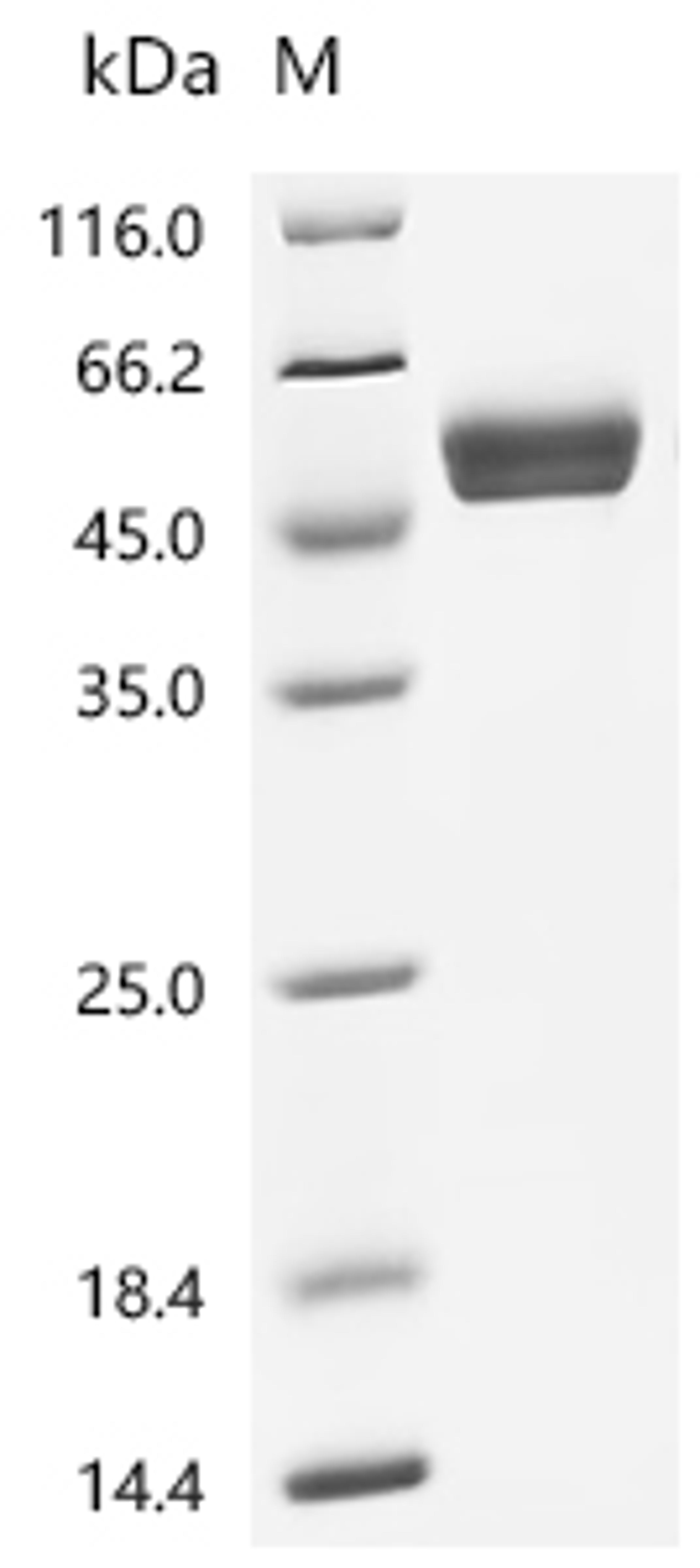 (Tris-Glycine gel) Discontinuous SDS-PAGE (reduced) with 5% enrichment gel and 15% separation gel.