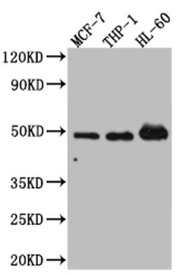 Western Blot. Positive WB detected in: MCF-7 whole cell lysate, THP-1 whole cell lysate, HL-60 whole cell lysate. All lanes: Vitamin D antibody at 1:1000. Secondary. Goat polyclonal to rabbit IgG at 1/50000 dilution. Predicted band size: 49, 54 kDa. Observed band size: 49 kDa. 
