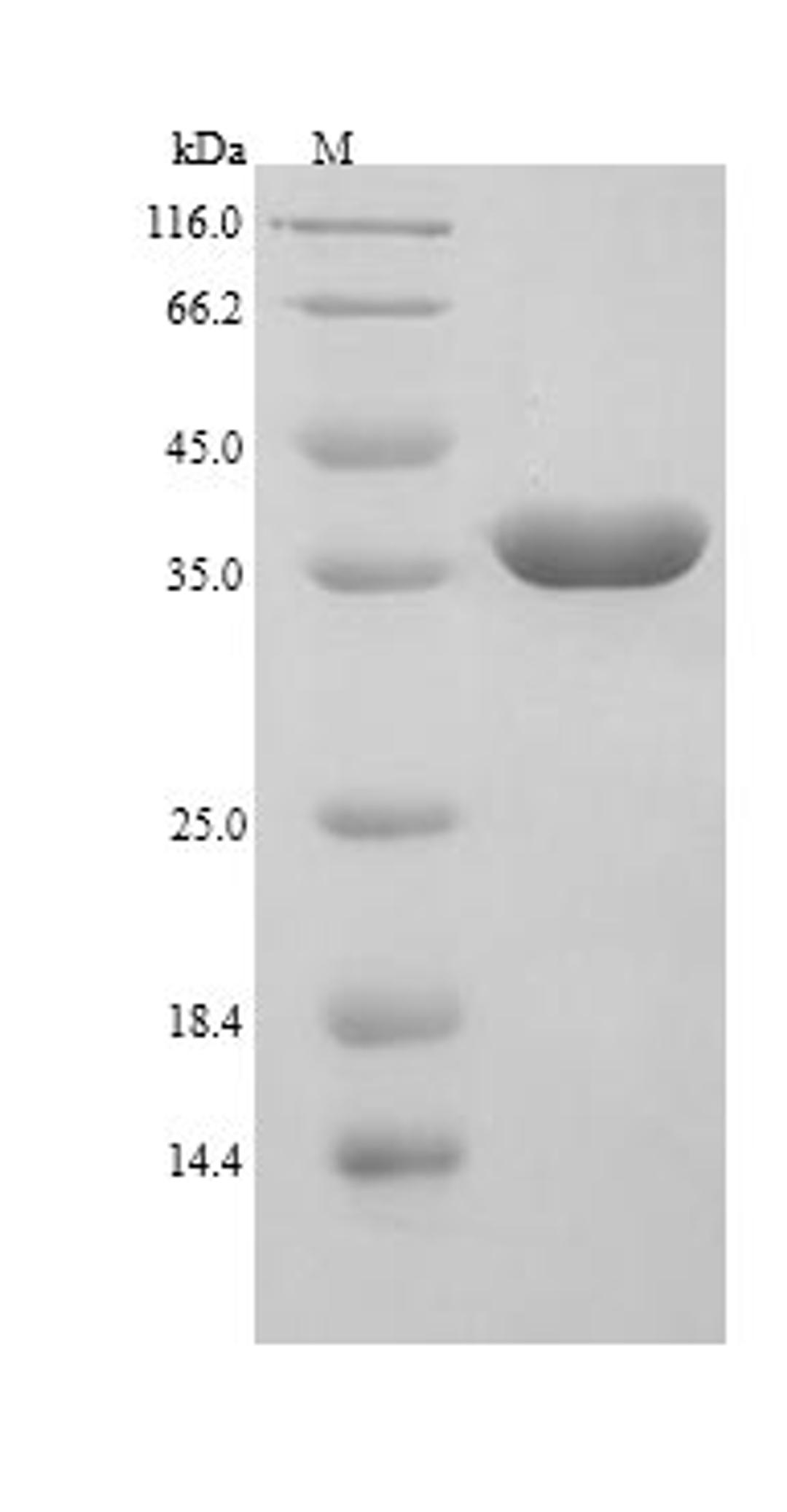 (Tris-Glycine gel) Discontinuous SDS-PAGE (reduced) with 5% enrichment gel and 15% separation gel.