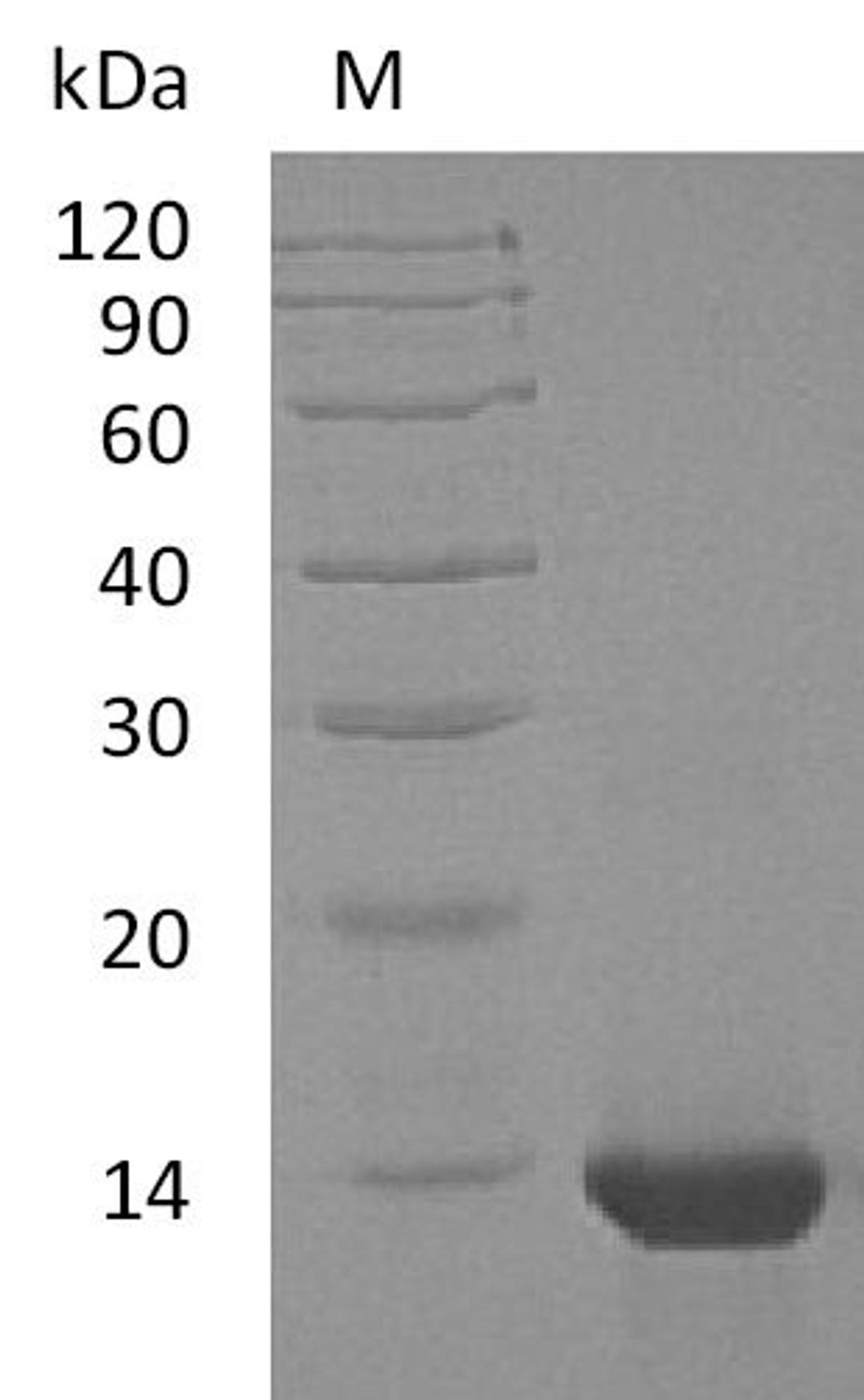 (Tris-Glycine gel) Discontinuous SDS-PAGE (reduced) with 5% enrichment gel and 15% separation gel.