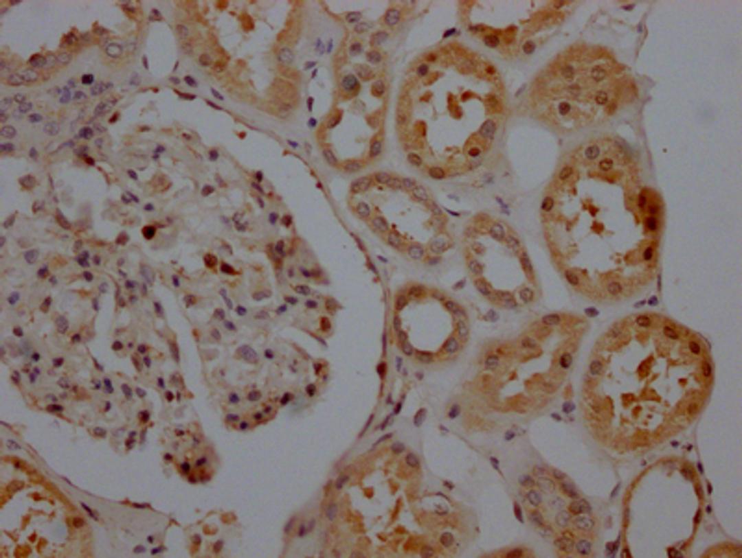 IHC image of CSB-RA156557A0HU diluted at 1:100 and staining in paraffin-embedded human kidney tissue performed on a Leica BondTM system. After dewaxing and hydration, antigen retrieval was mediated by high pressure in a citrate buffer (pH 6.0). Section was blocked with 10% normal goat serum 30min at RT. Then primary antibody (1% BSA) was incubated at 4℃ overnight. The primary is detected by a Goat anti-rabbit IgG polymer labeled by HRP and visualized using 0.05% DAB.