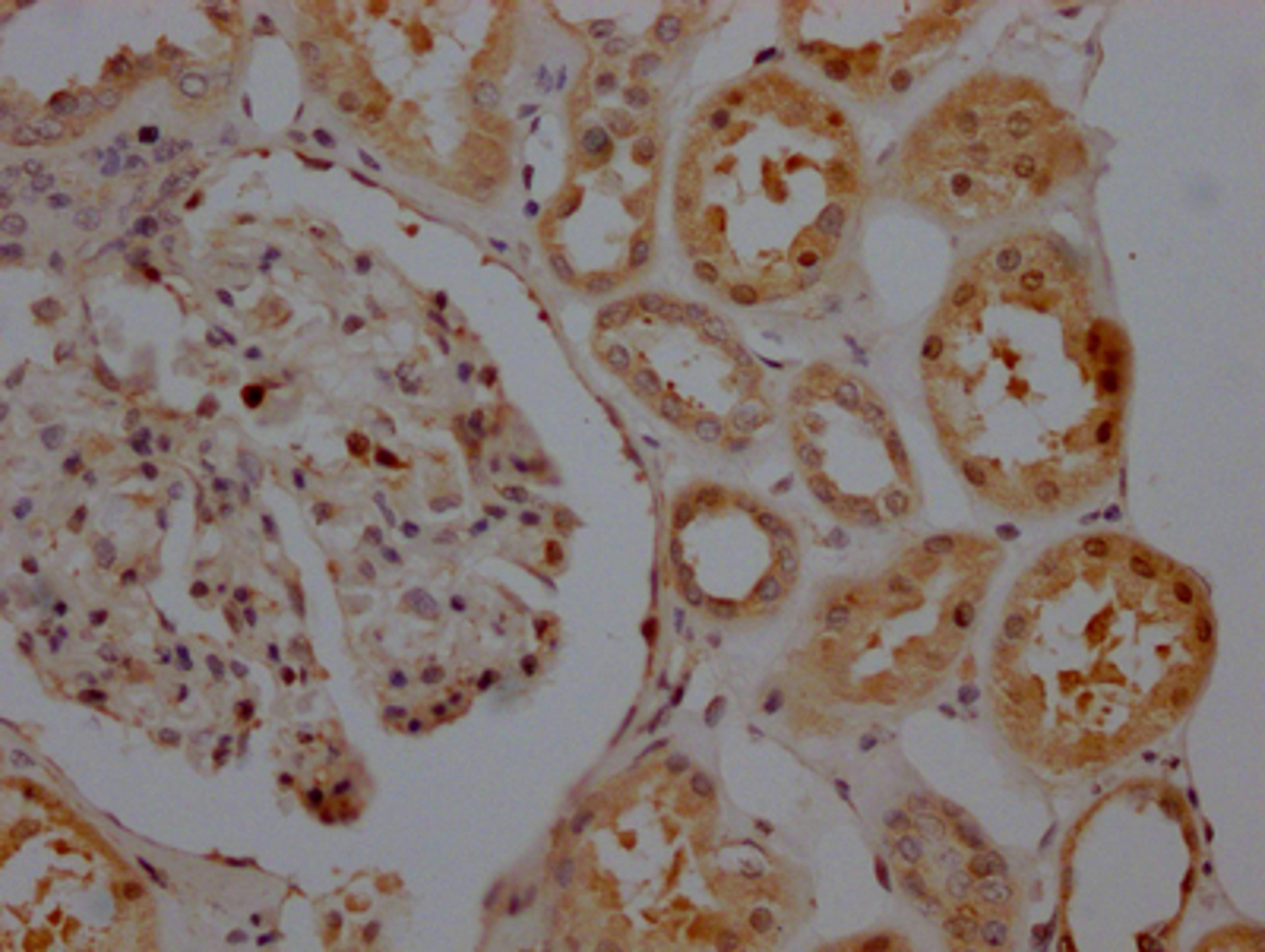 IHC image of CSB-RA156557A0HU diluted at 1:100 and staining in paraffin-embedded human kidney tissue performed on a Leica BondTM system. After dewaxing and hydration, antigen retrieval was mediated by high pressure in a citrate buffer (pH 6.0). Section was blocked with 10% normal goat serum 30min at RT. Then primary antibody (1% BSA) was incubated at 4℃ overnight. The primary is detected by a Goat anti-rabbit IgG polymer labeled by HRP and visualized using 0.05% DAB.
