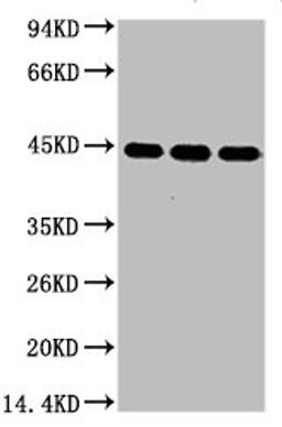Western blot analysis of 1) Hela, 2) Mouse Brain tissue, 3) Rat Brain tissue, diluted at 1:5000.