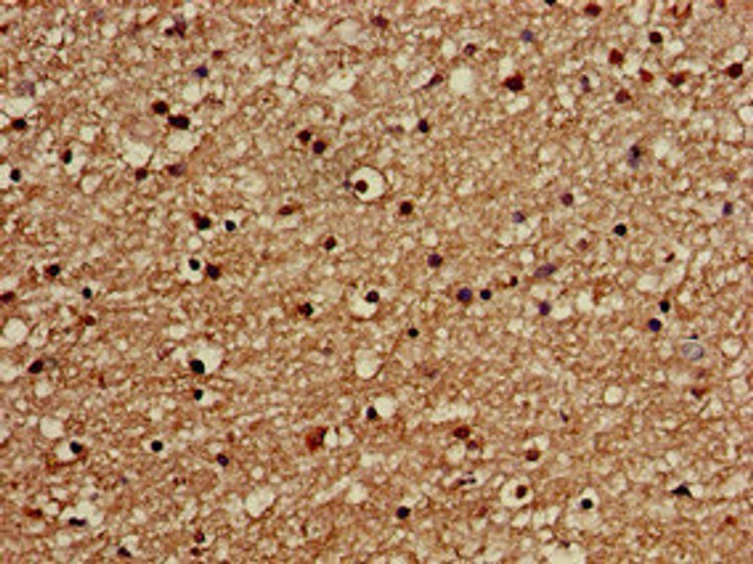 Immunohistochemistry of paraffin-embedded human brain tissue using CSB-PA600096LA01HU at dilution of 1:100