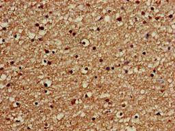 Immunohistochemistry of paraffin-embedded human brain tissue using CSB-PA600096LA01HU at dilution of 1:100