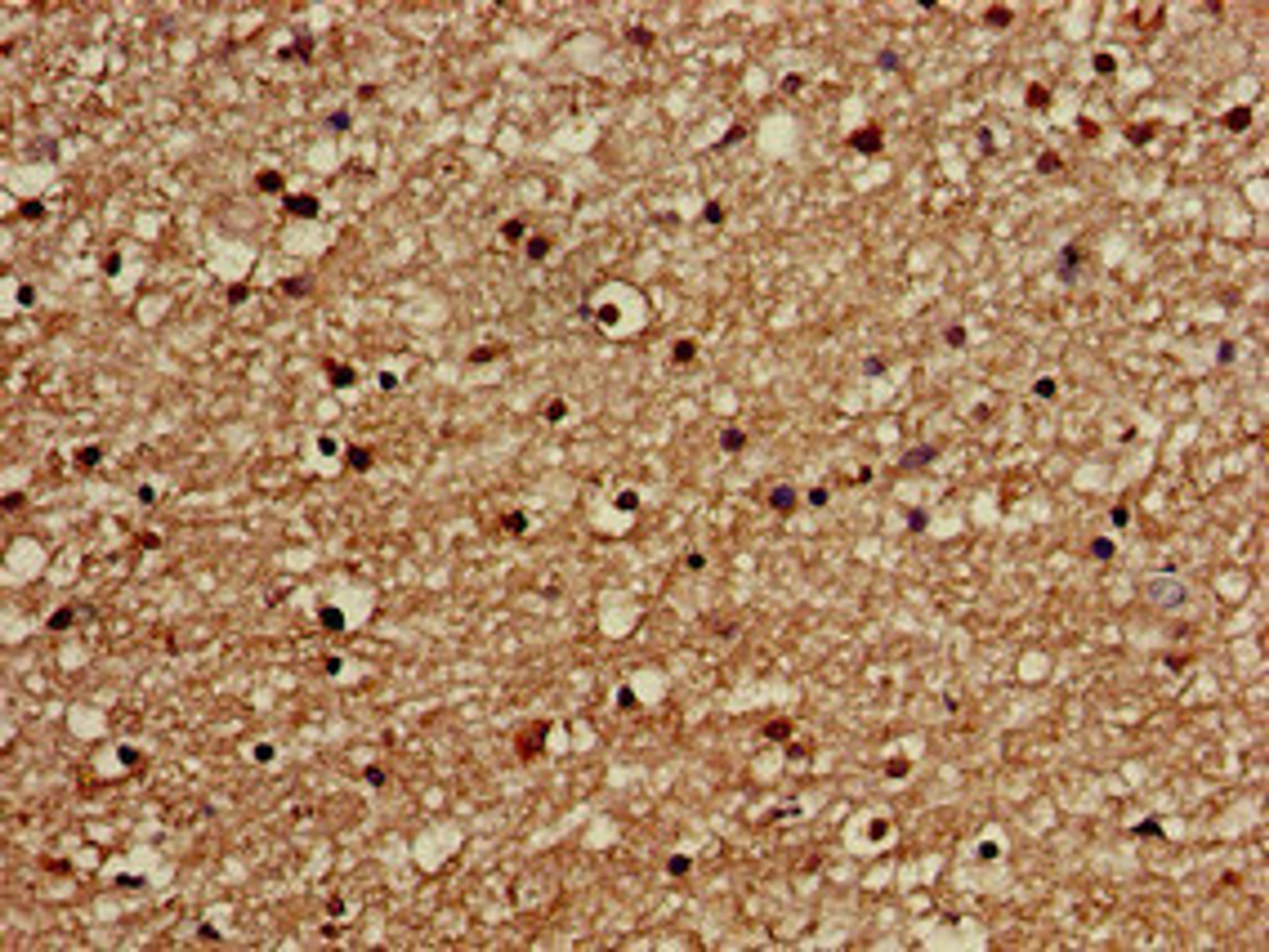 Immunohistochemistry of paraffin-embedded human brain tissue using CSB-PA600096LA01HU at dilution of 1:100