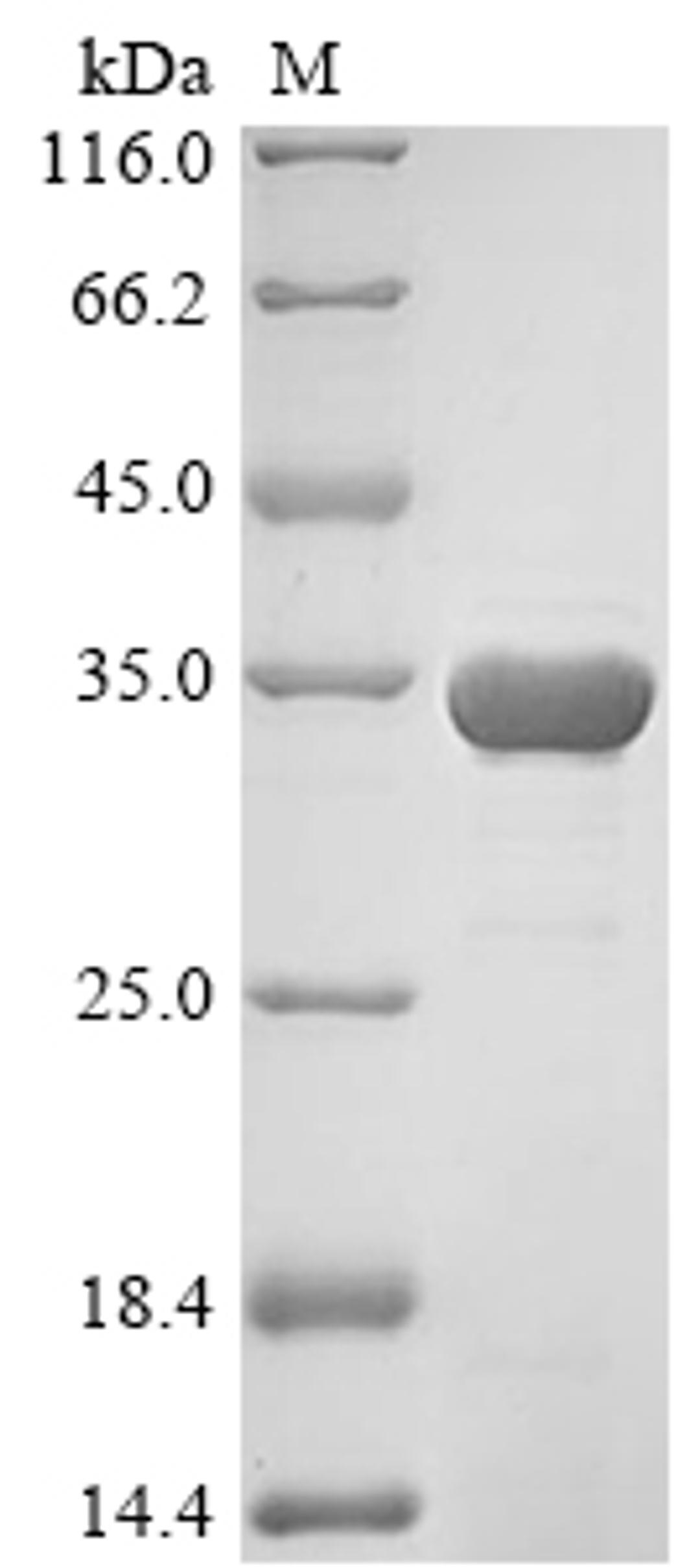 (Tris-Glycine gel) Discontinuous SDS-PAGE (reduced) with 5% enrichment gel and 15% separation gel.
