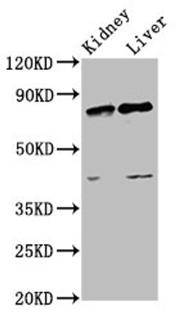 Western Blot. Positive WB detected in: Rat kidney tissue, Rat liver tissue. All lanes: SUZ12 antibody at 3.4ug/ml. Secondary. Goat polyclonal to rabbit IgG at 1/50000 dilution. Predicted band size: 84 kDa. Observed band size: 84 kDa. 